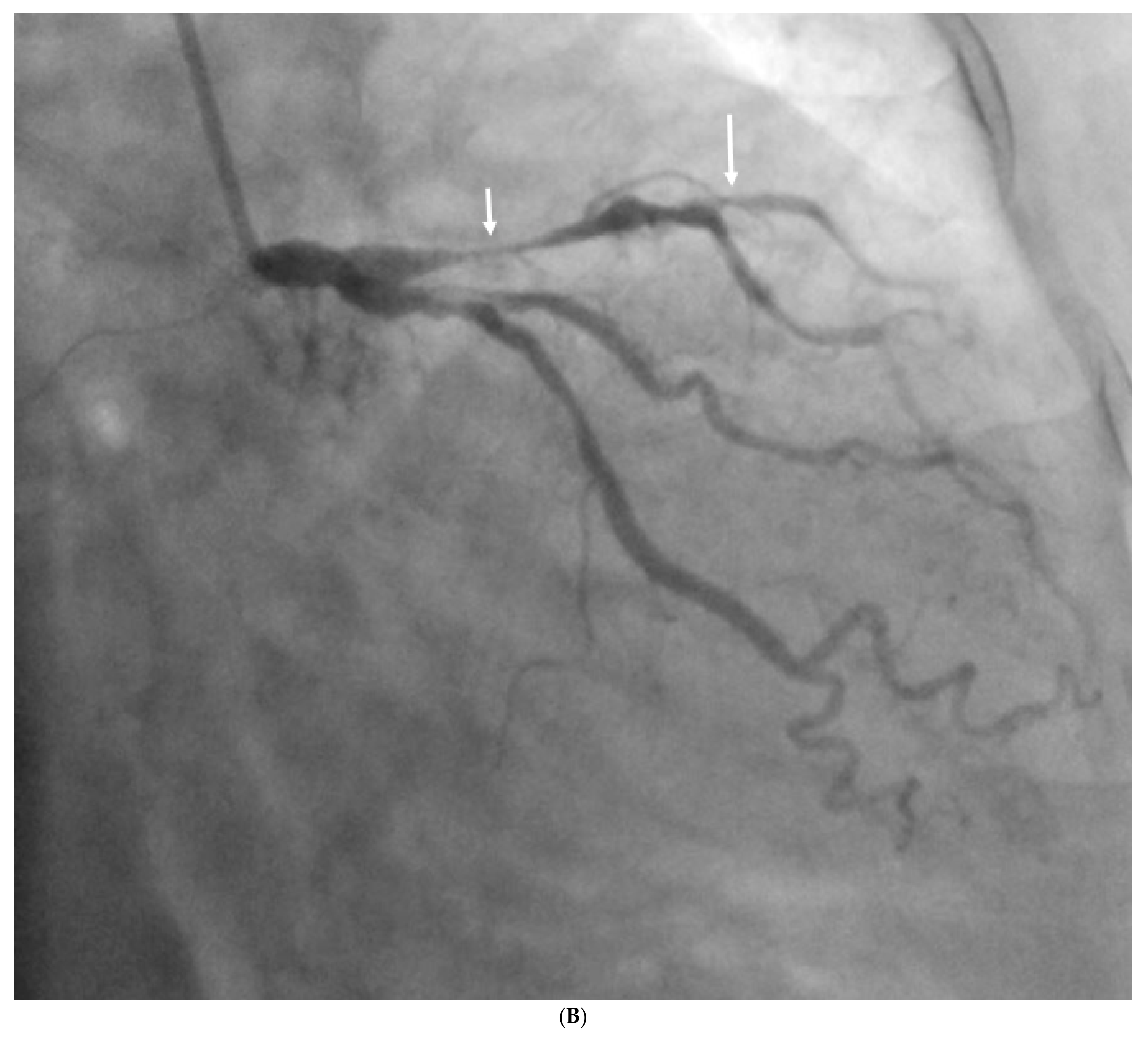 Jcdd 11 00022 g028b Jcdd 11 00022 g028b