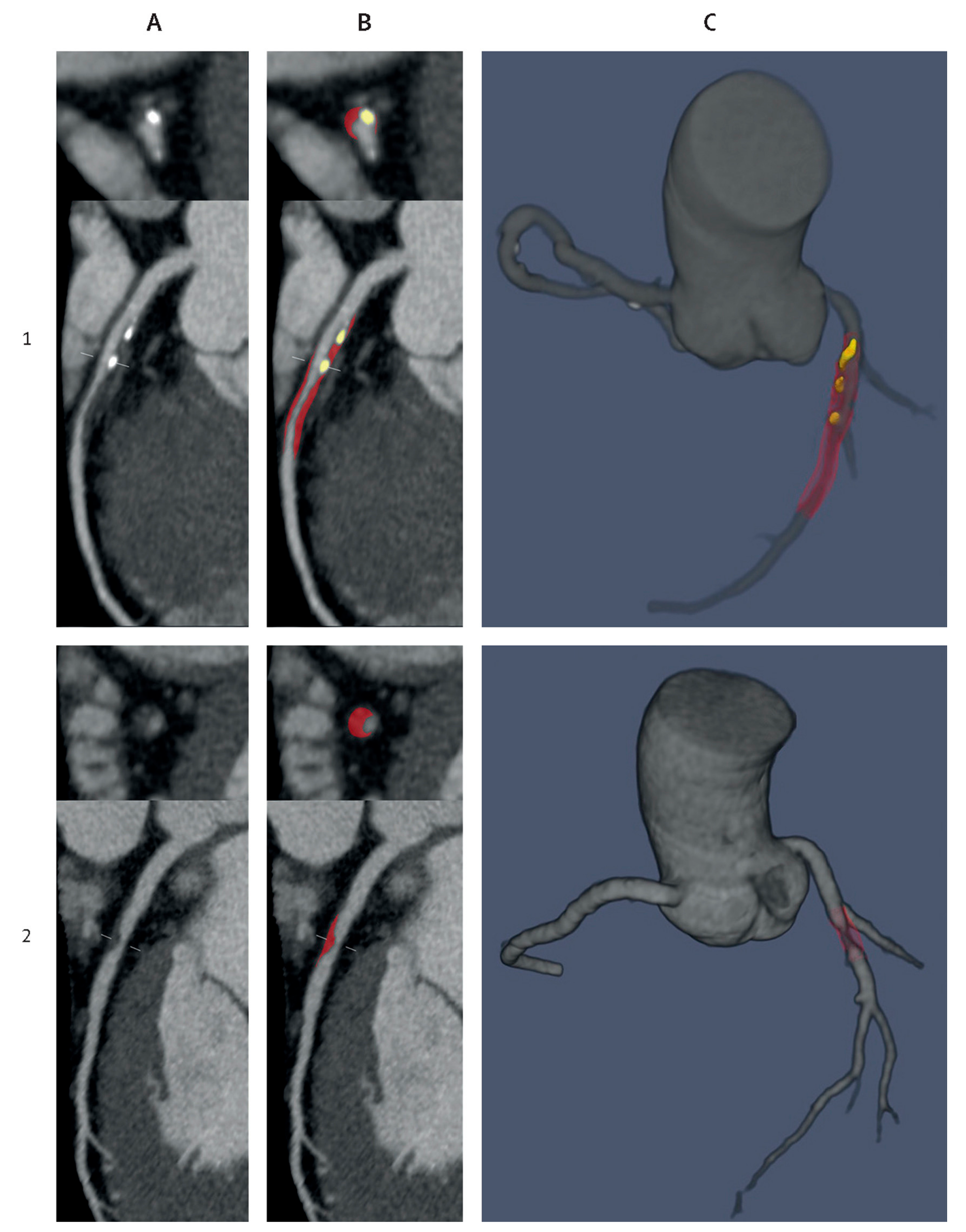 Jcdd 11 00022 g029 Jcdd 11 00022 g029