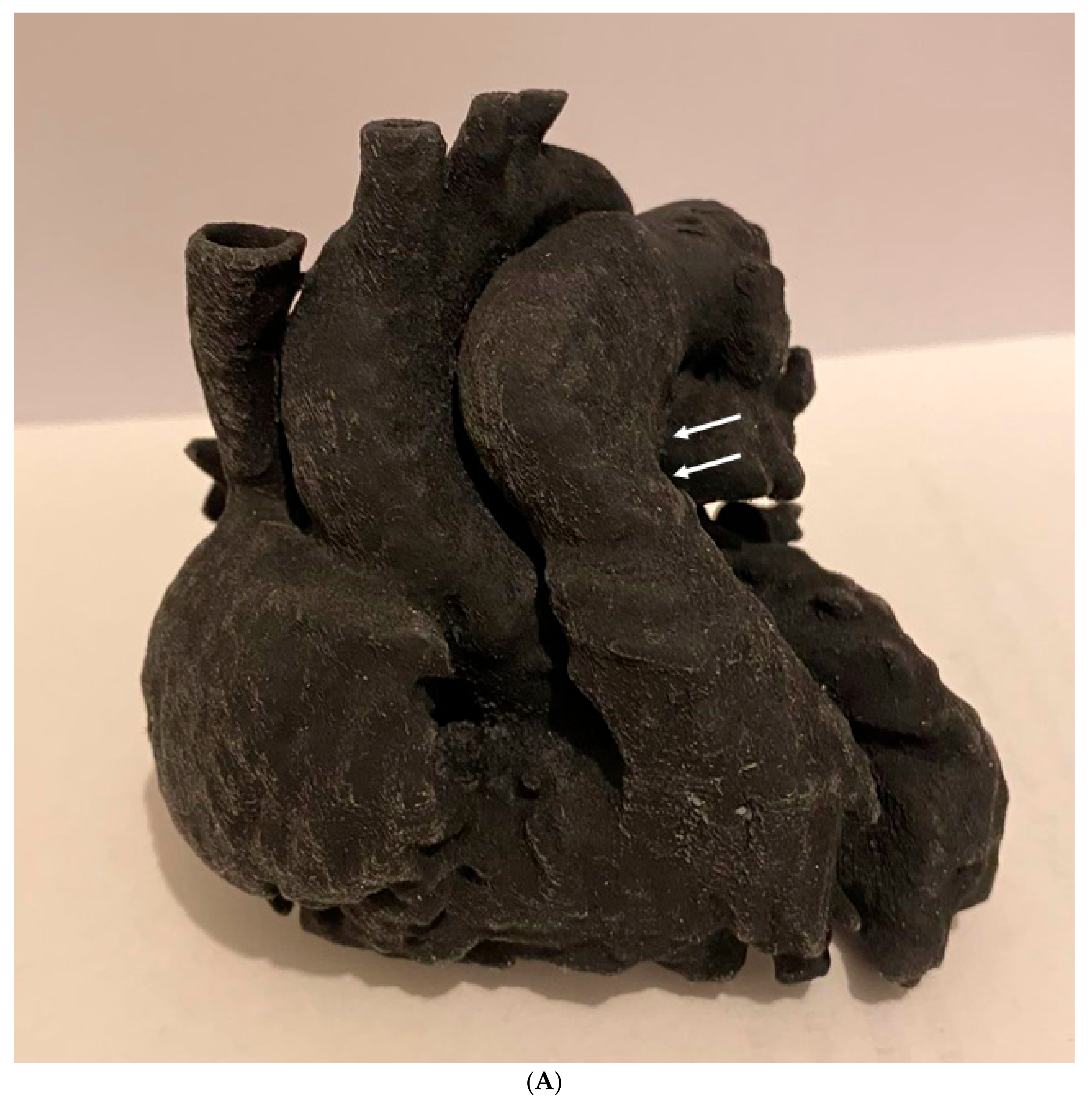 Jcdd 11 00022 g034a Jcdd 11 00022 g034a