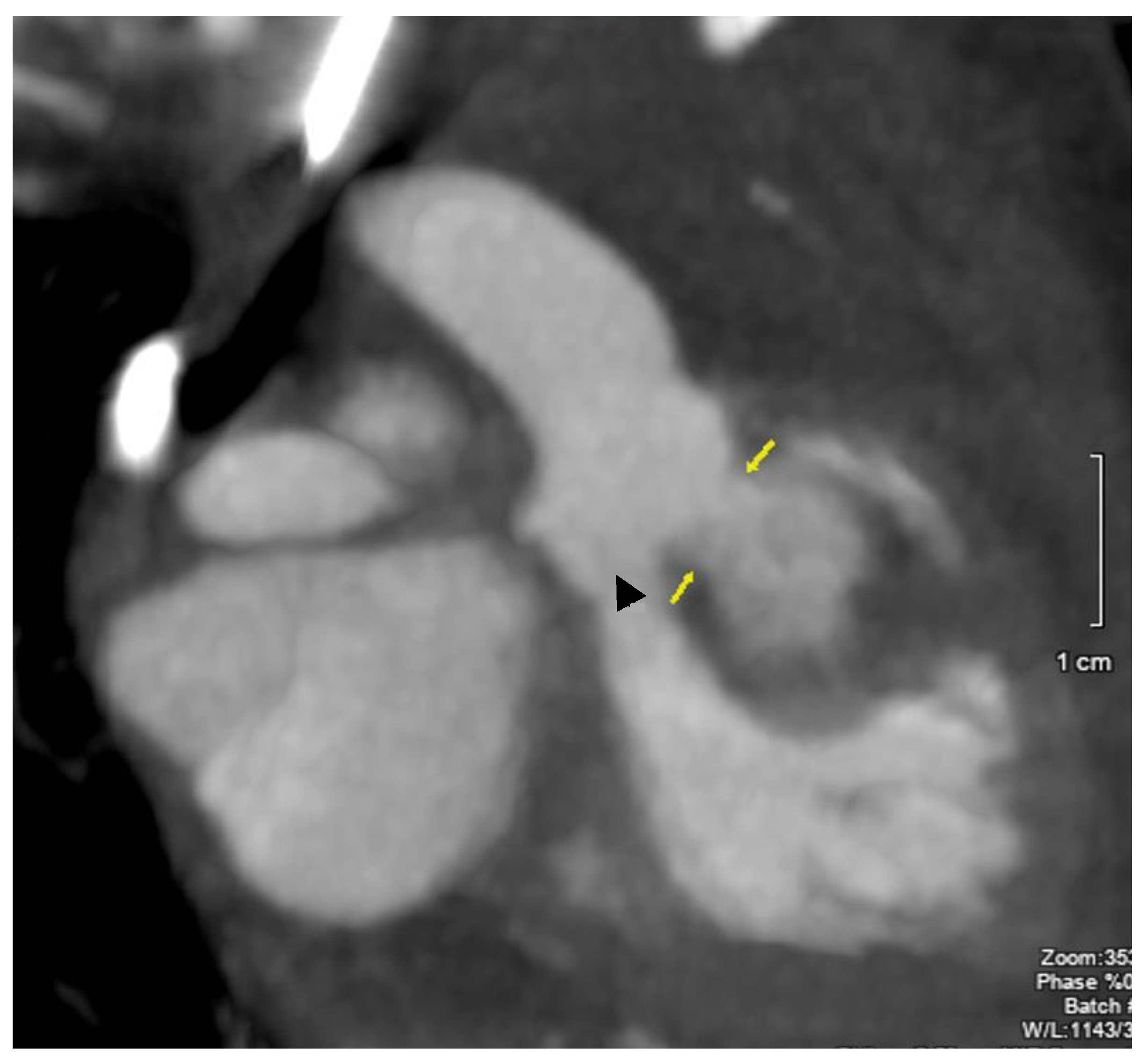 Jcdd 11 00023 g005 Jcdd 11 00023 g005