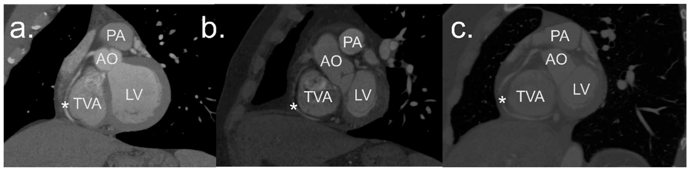 Jcdd 11 00159 g002 Jcdd 11 00159 g002