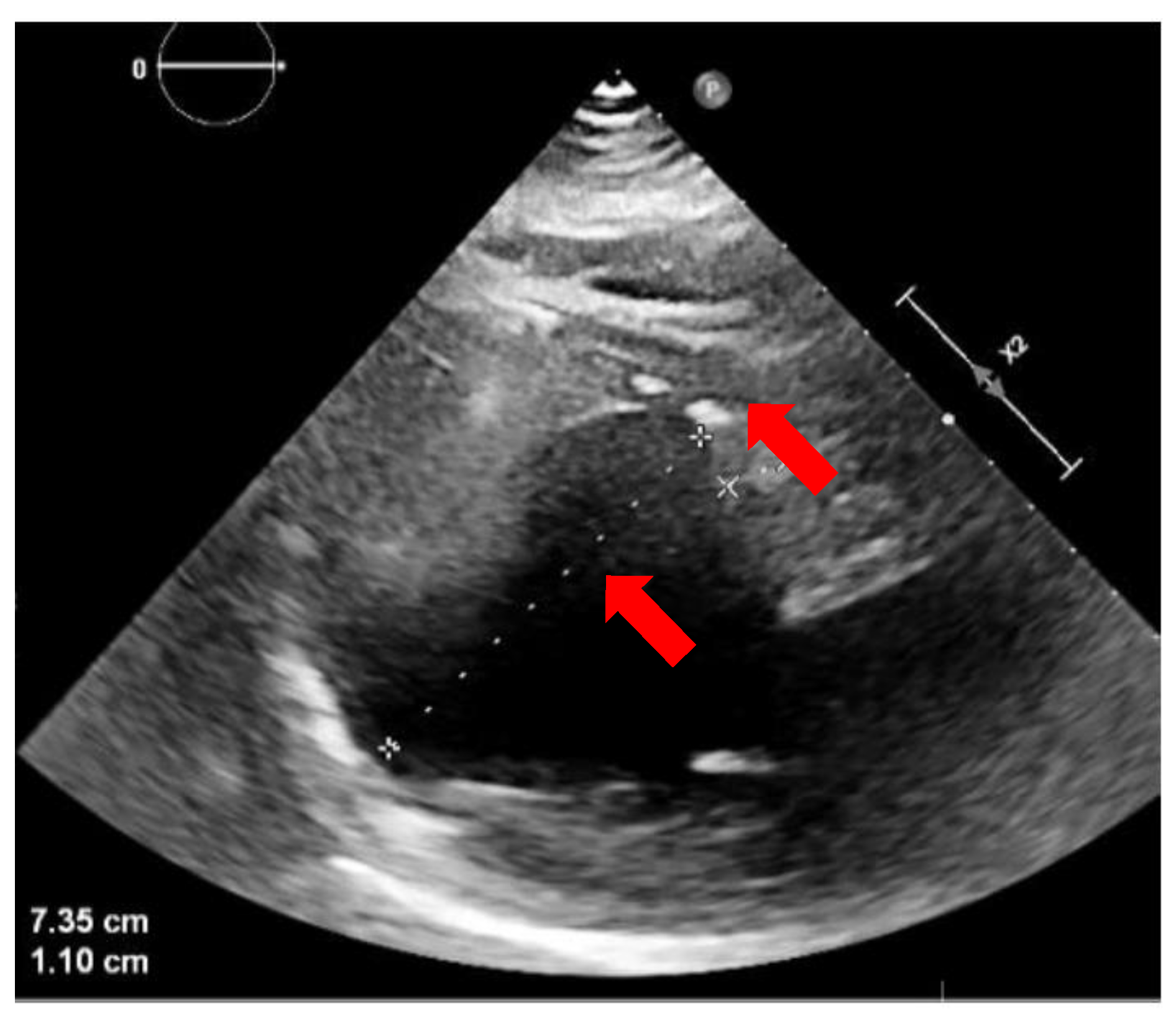 Jcdd 11 00239 g003 Jcdd 11 00239 g003