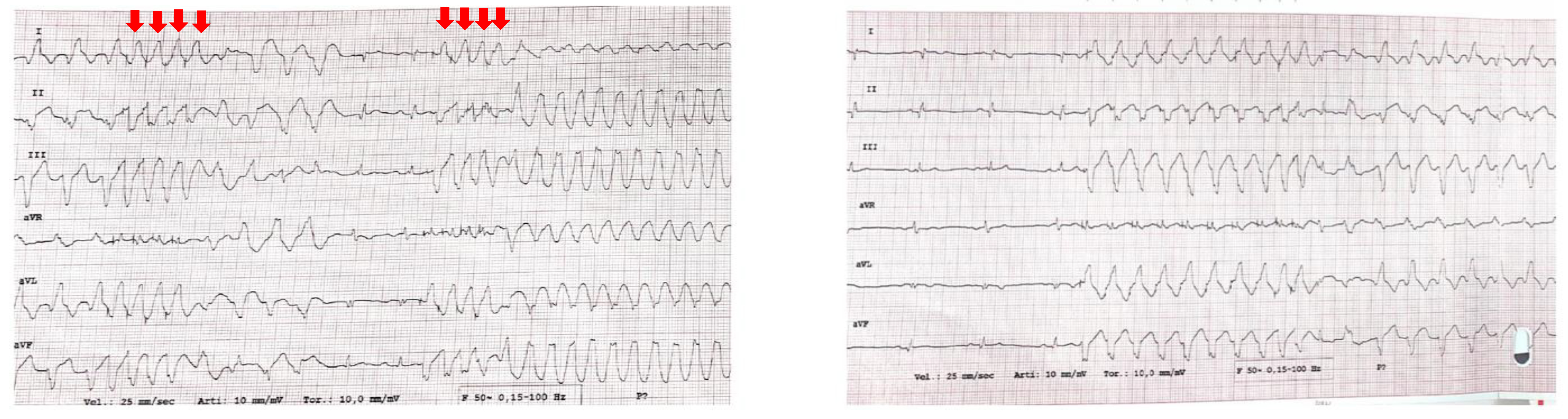 Jcdd 11 00239 g004 Jcdd 11 00239 g004