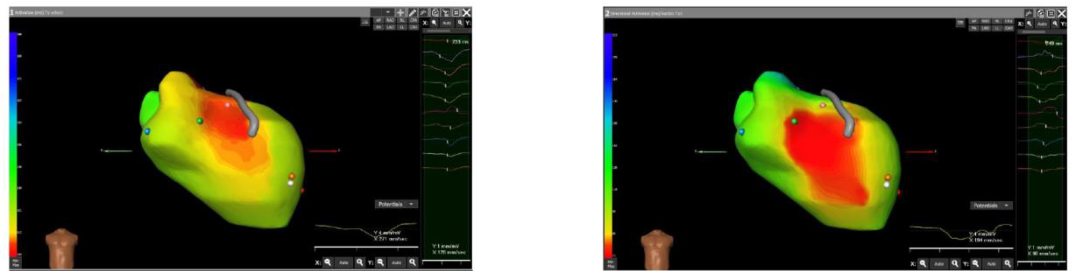 Jcdd 11 00239 g005 Jcdd 11 00239 g005