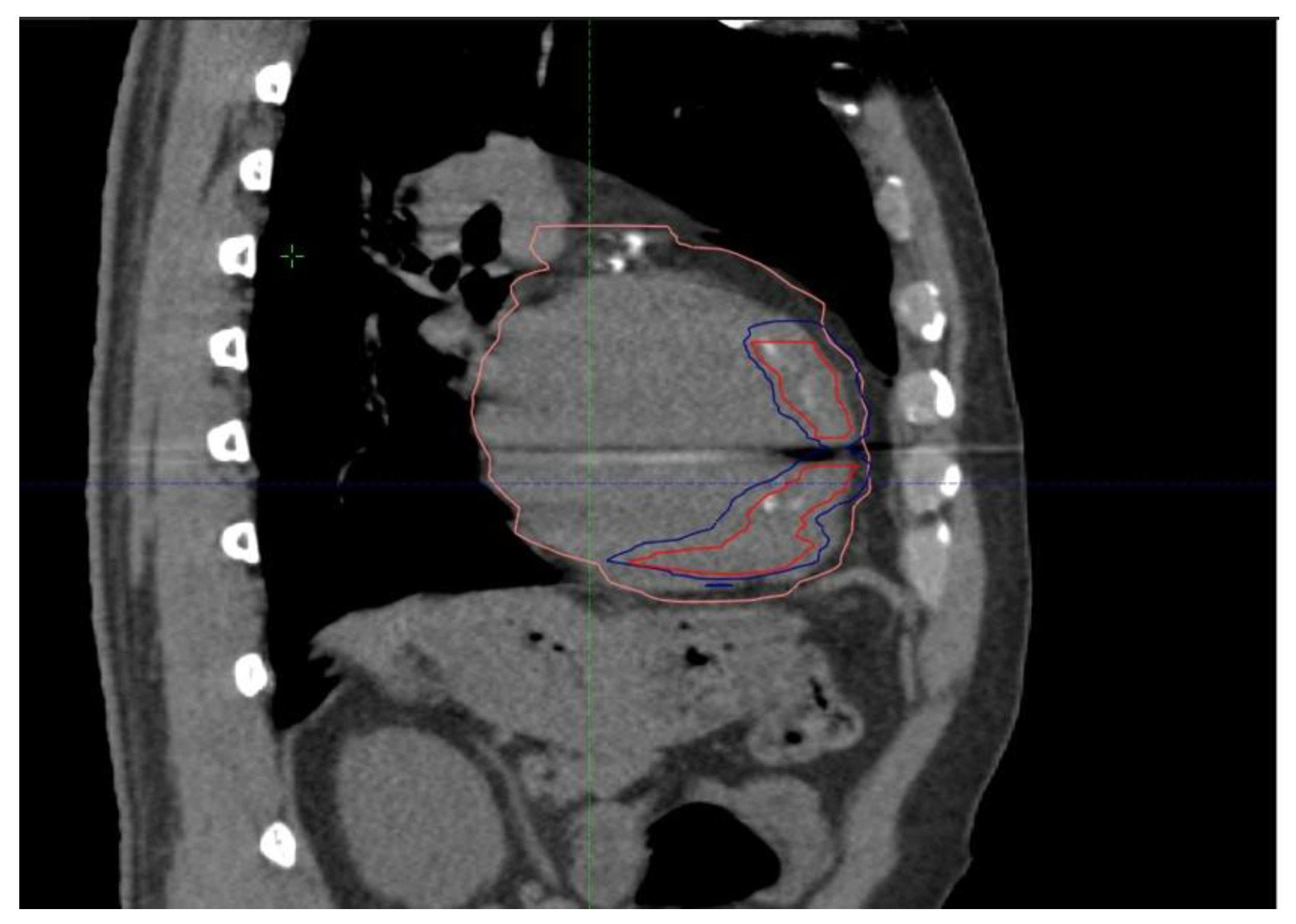 Jcdd 11 00239 g006 Jcdd 11 00239 g006