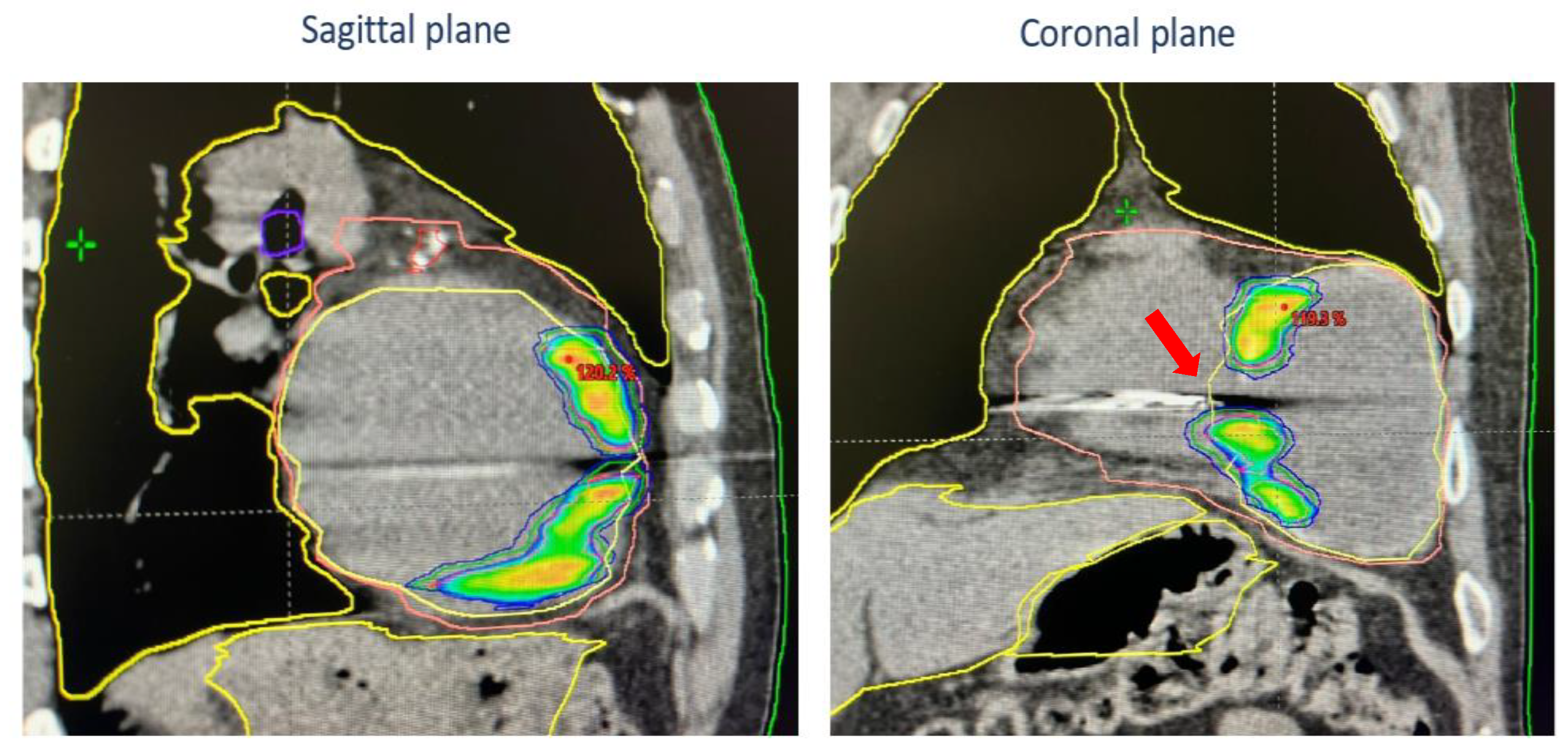 Jcdd 11 00239 g007 Jcdd 11 00239 g007