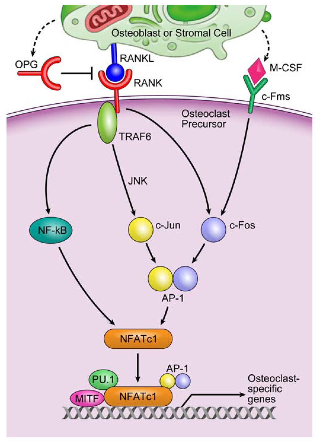 JCM | Free Full-Text | MicroRNAs and Osteolytic Bone Metastasis: The ...