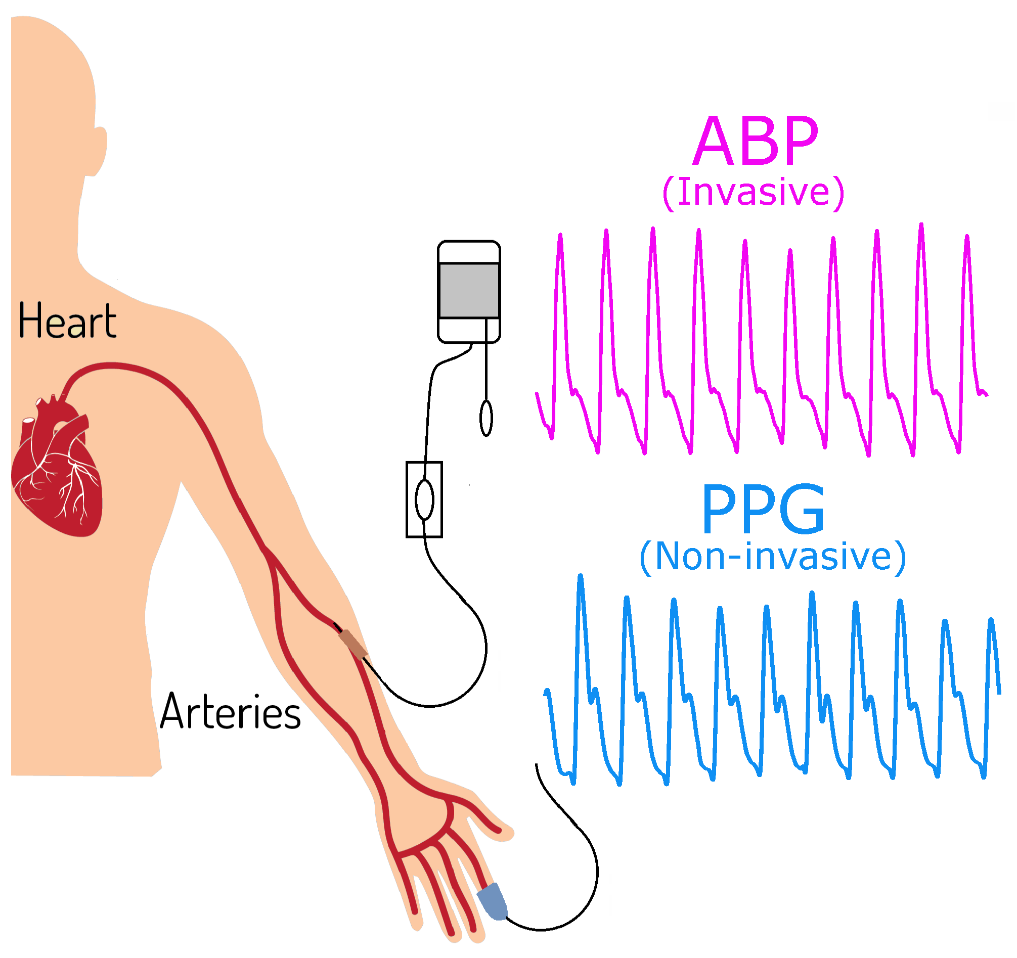 JCM | Free Full-Text | Can Photoplethysmography Replace Arterial Blood  Pressure in the Assessment of Blood Pressure?
