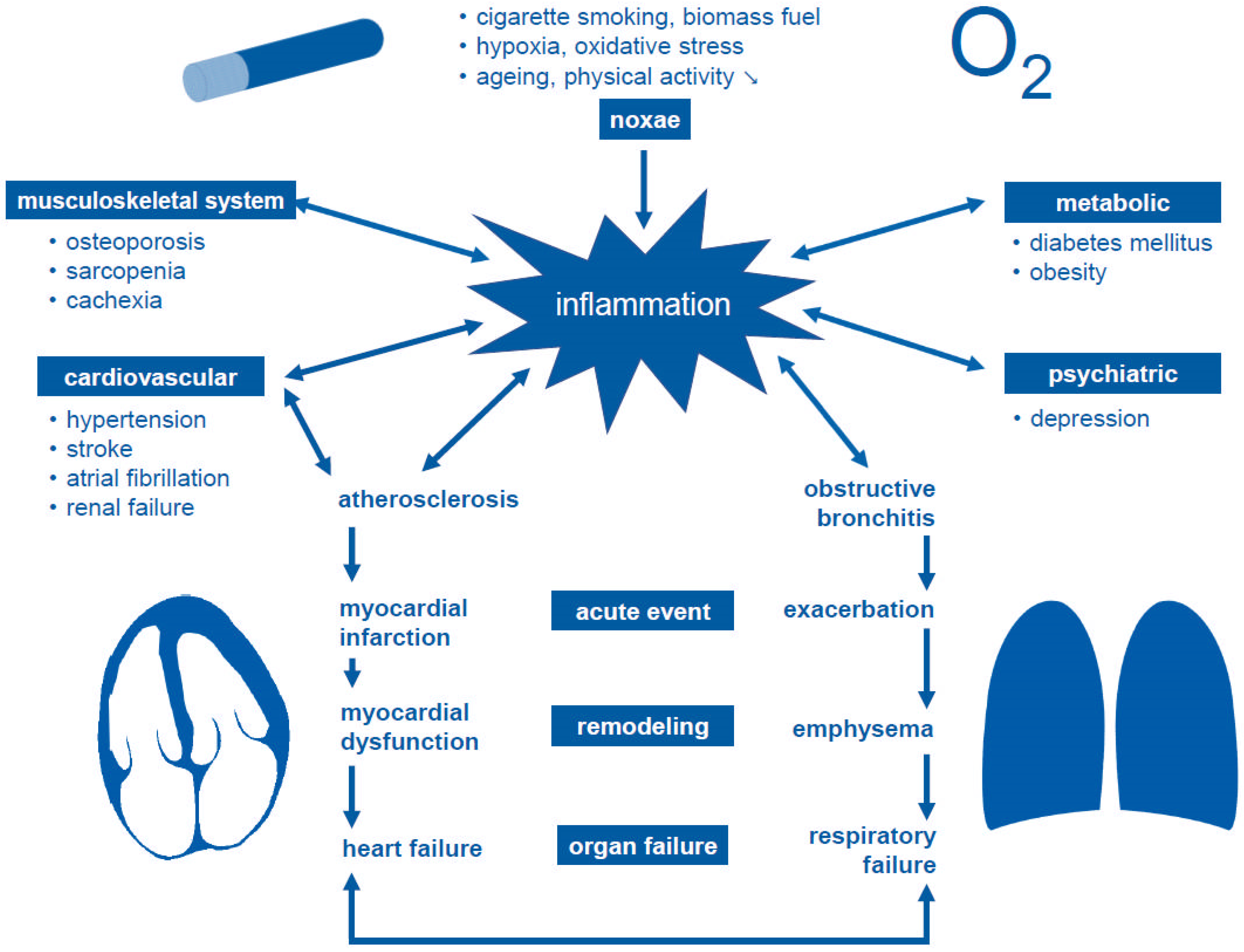 JCM | Free Full-Text | Cardiovascular Comorbidities in Chronic Obstructive  Pulmonary Disease (COPD)—Current Considerations for Clinical Practice