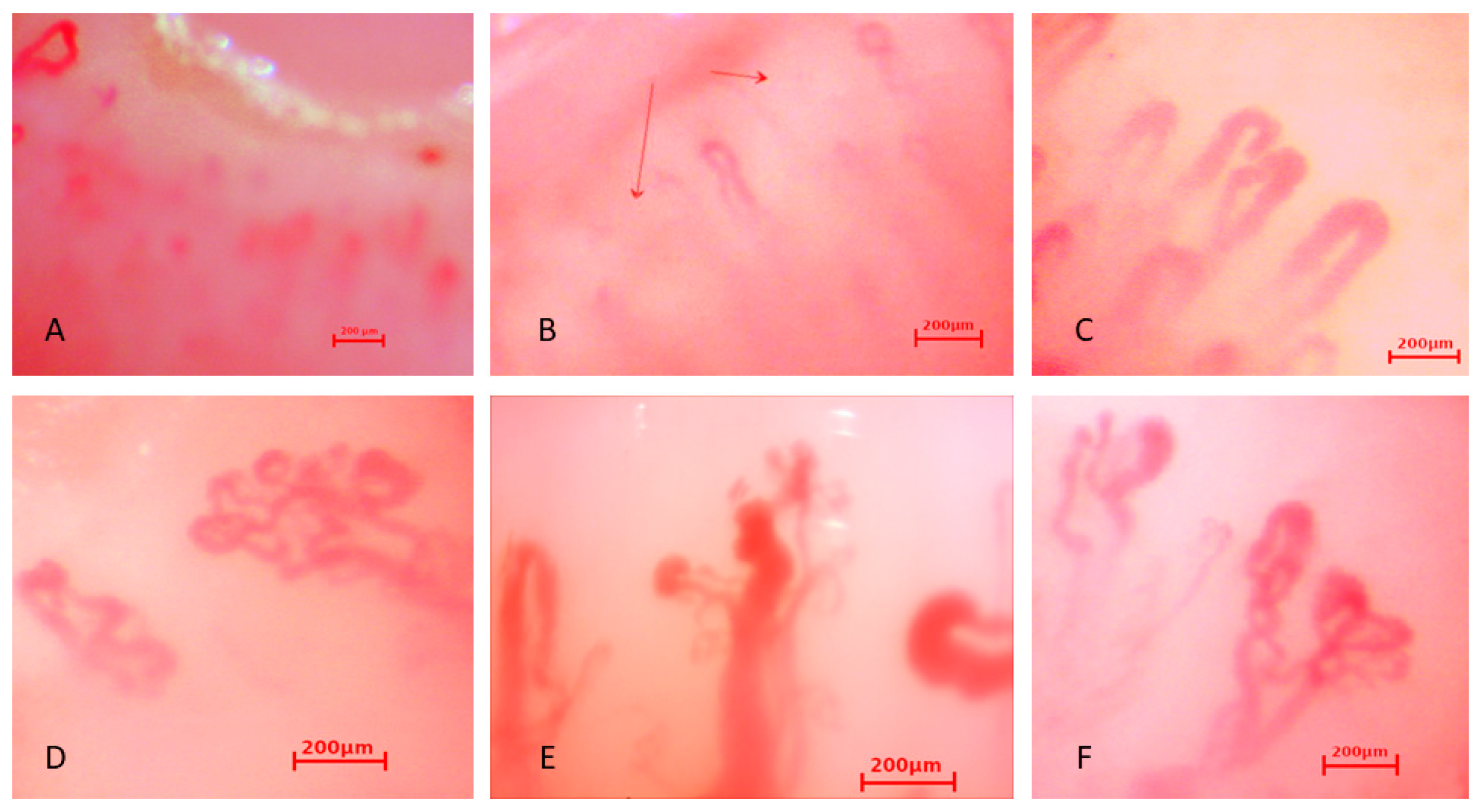 JCM | Free Full-Text | Microangiopathy in Naifold Videocapillaroscopy and  Its Relations to sE- Selectin, Endothelin-1, and hsCRP as Putative  Endothelium Dysfunction Markers among Adolescents with Raynaud's Phenomenon  | HTML