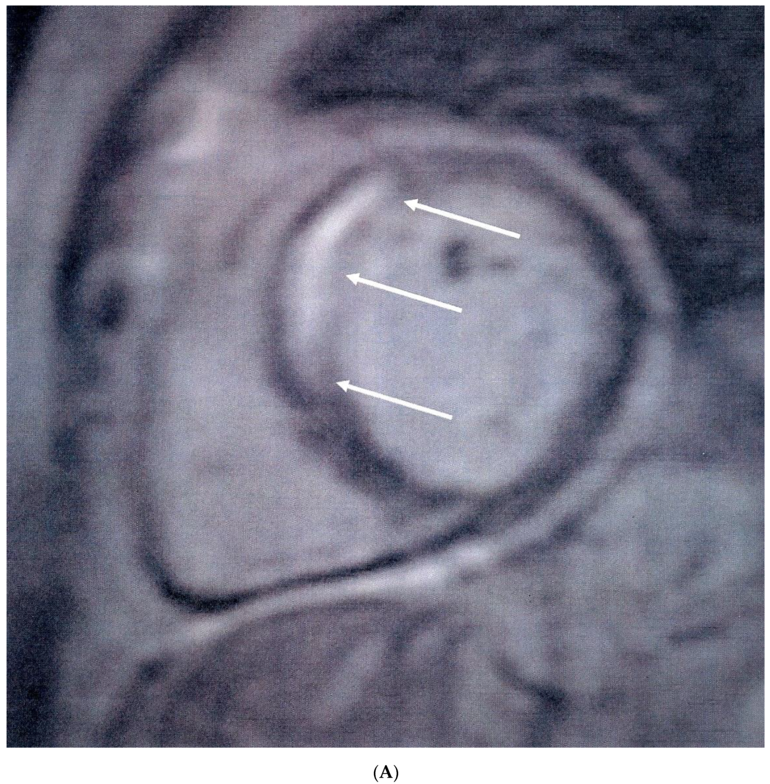 Jcm 08 01084 g001a Jcm 08 01084 g001a