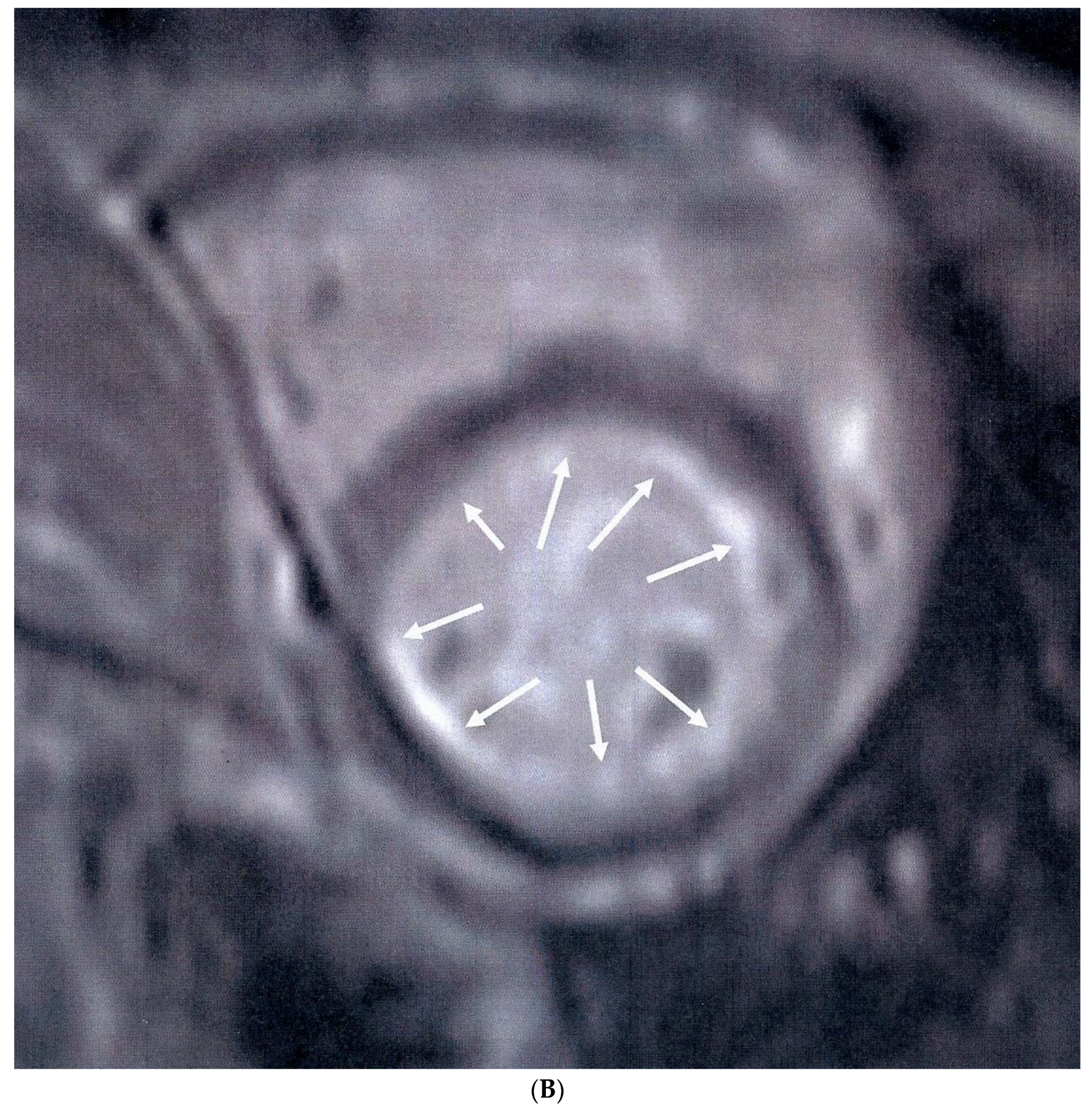 Jcm 08 01084 g001b Jcm 08 01084 g001b