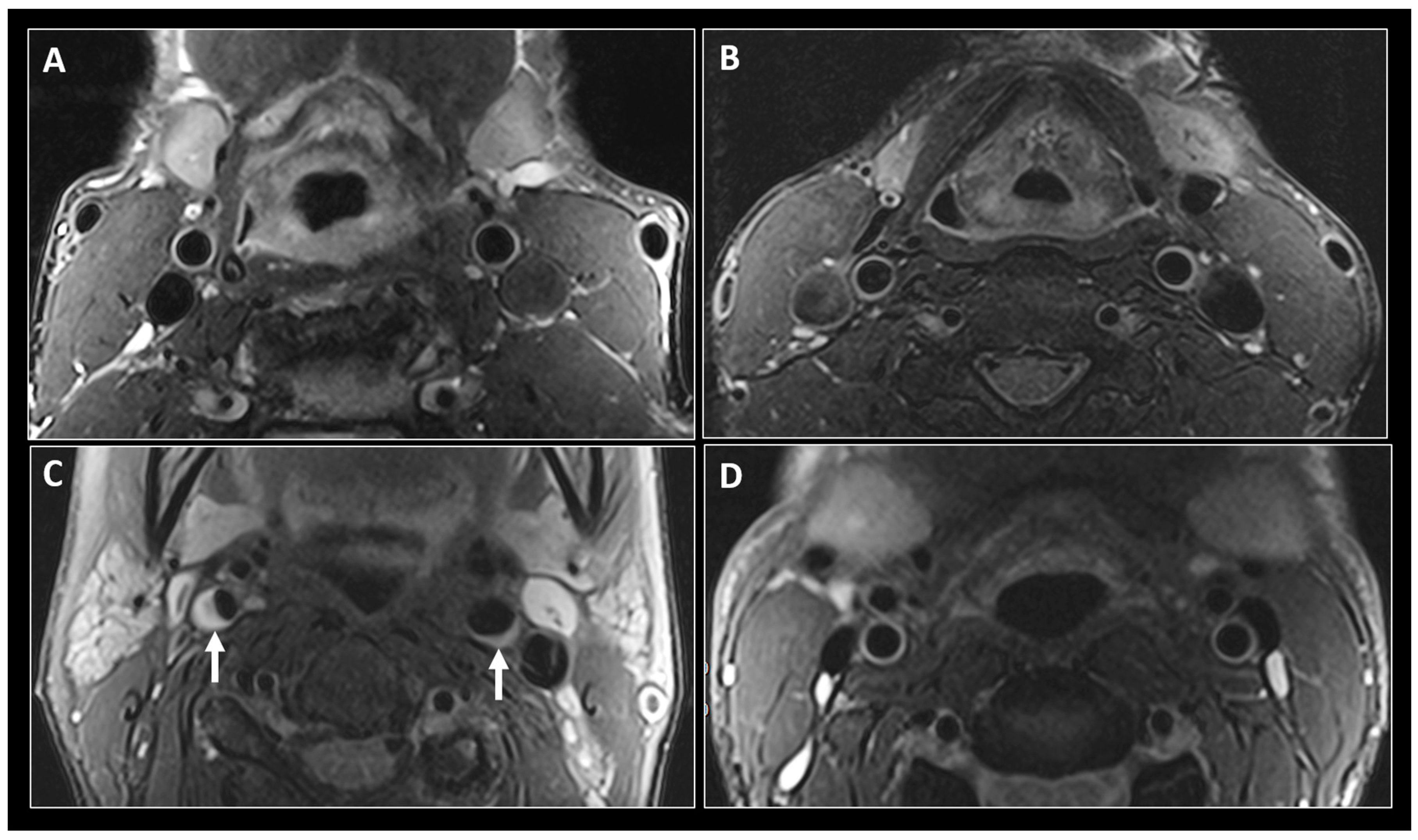 JCM | Free Full-Text | Subclinical Atherosclerosis Imaging in ...