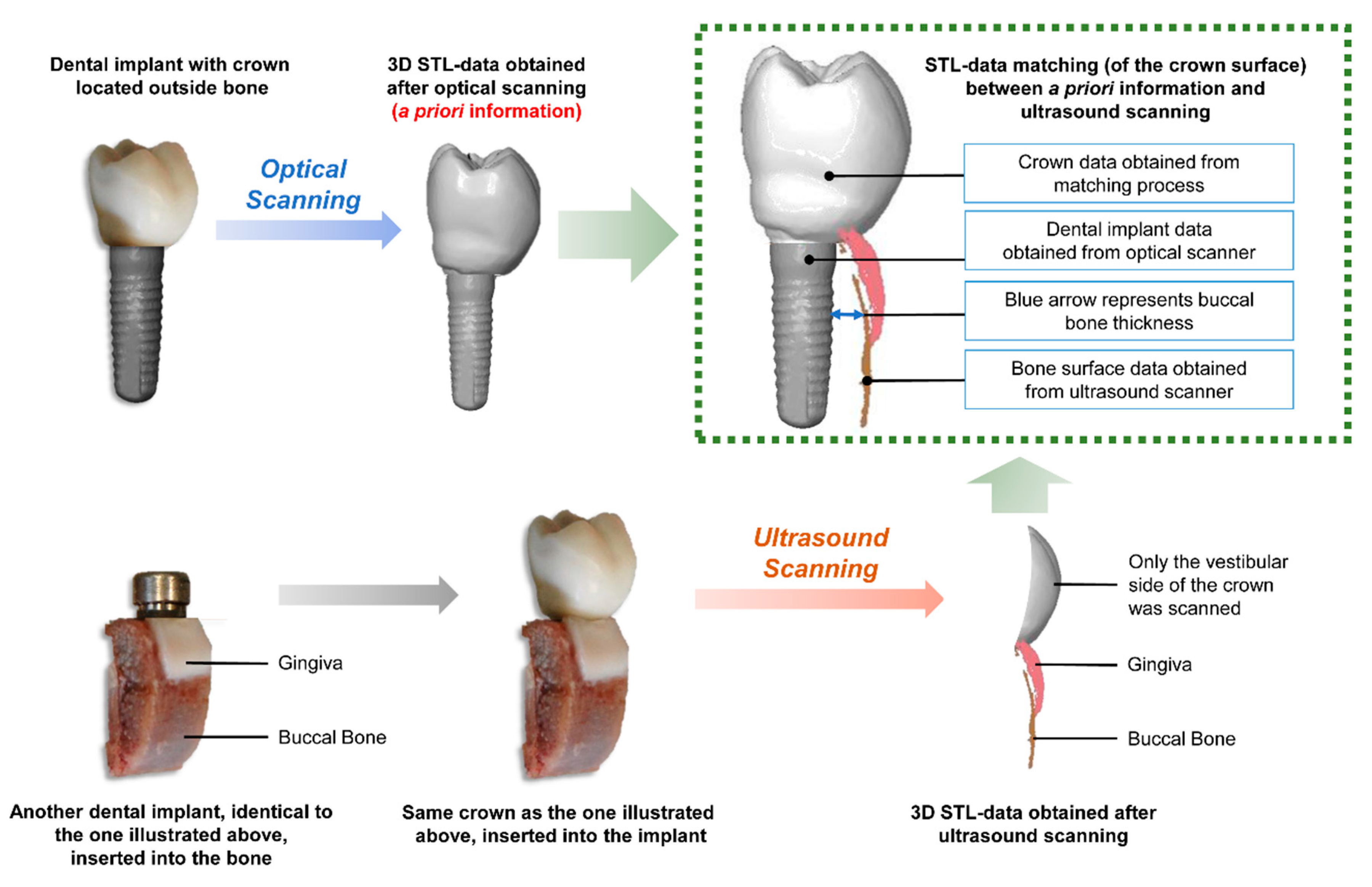 Implant research