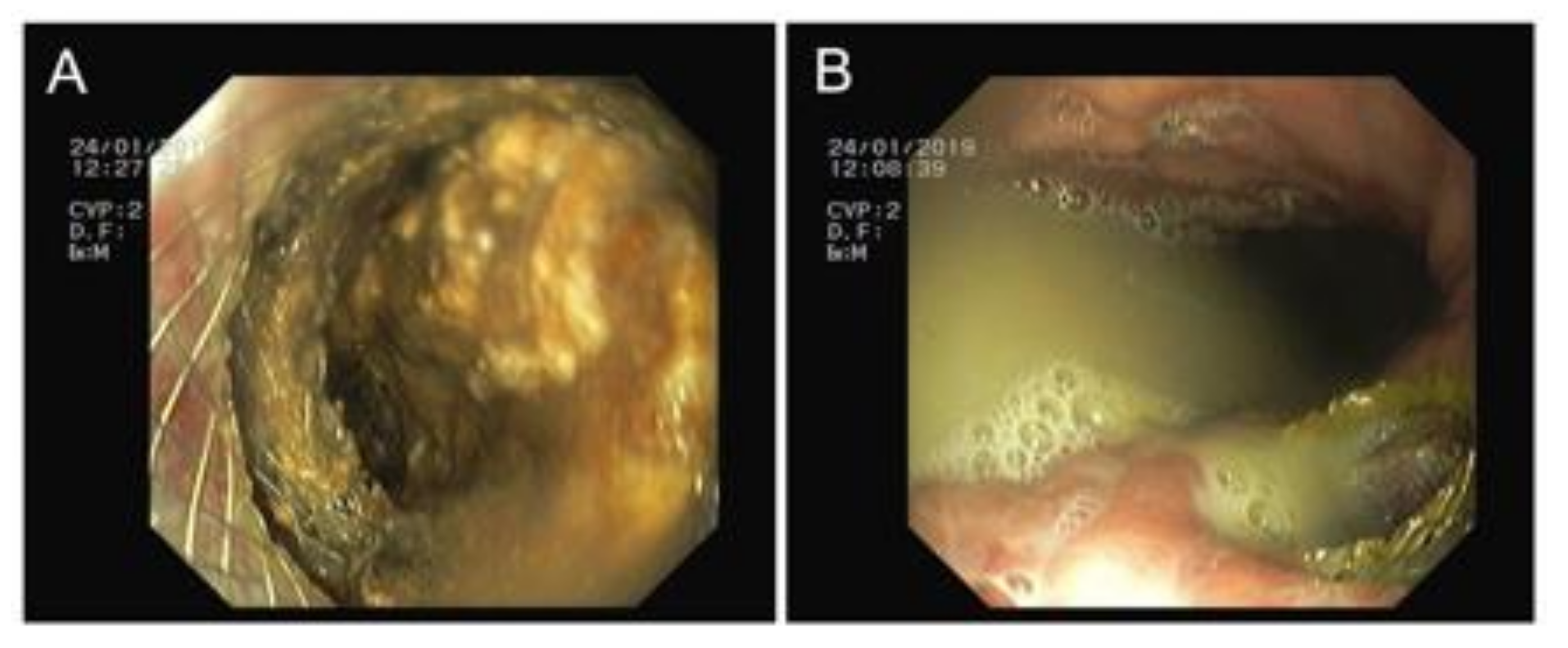 Jcm 08 01607 g003 Jcm 08 01607 g003