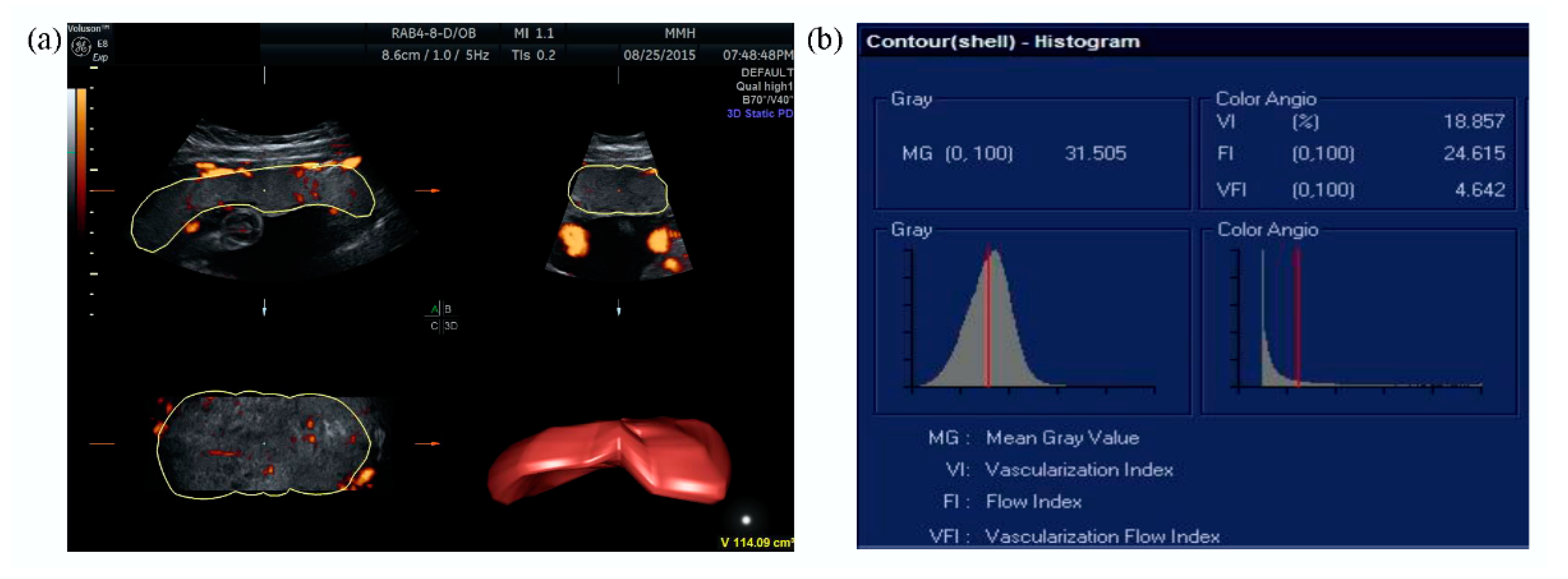 Jcm 08 01651 g001 Jcm 08 01651 g001