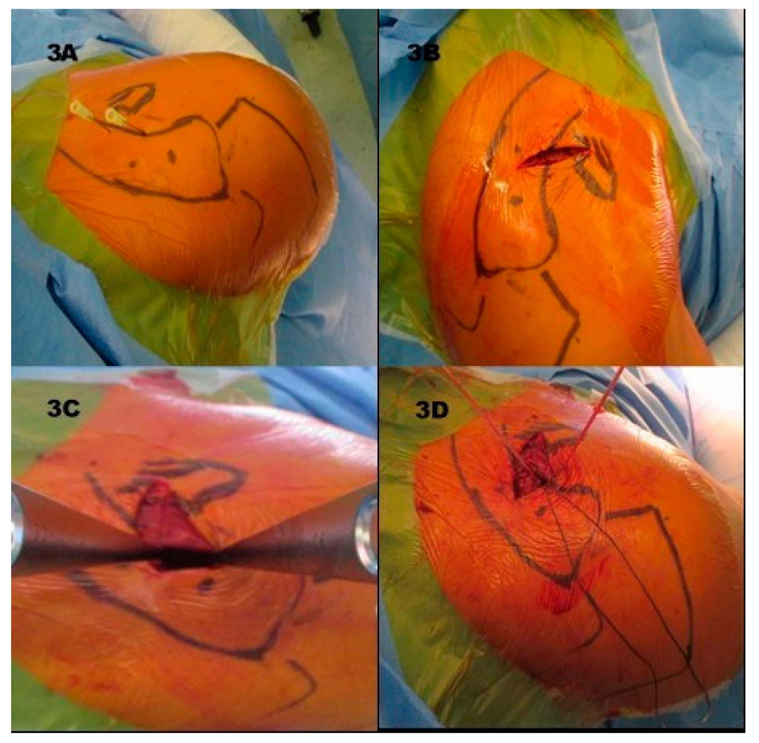 Jcm 08 01683 g003 Jcm 08 01683 g003