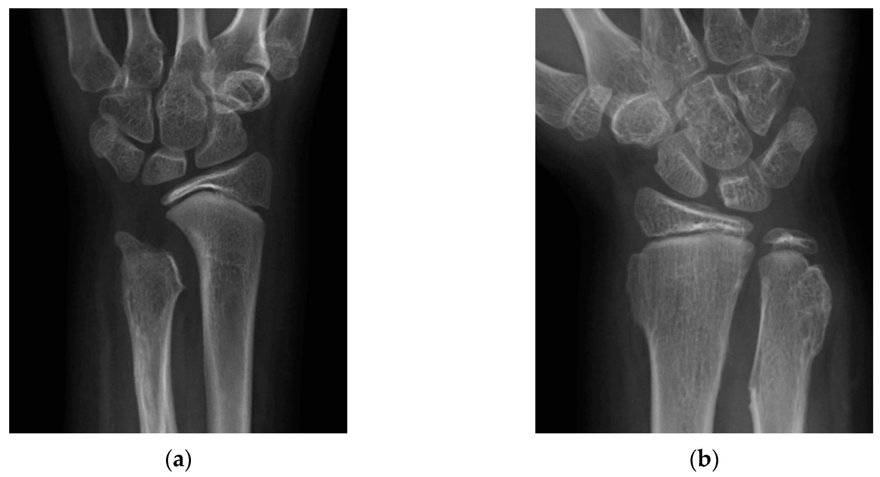 Jcm 08 01765 g005 Jcm 08 01765 g005