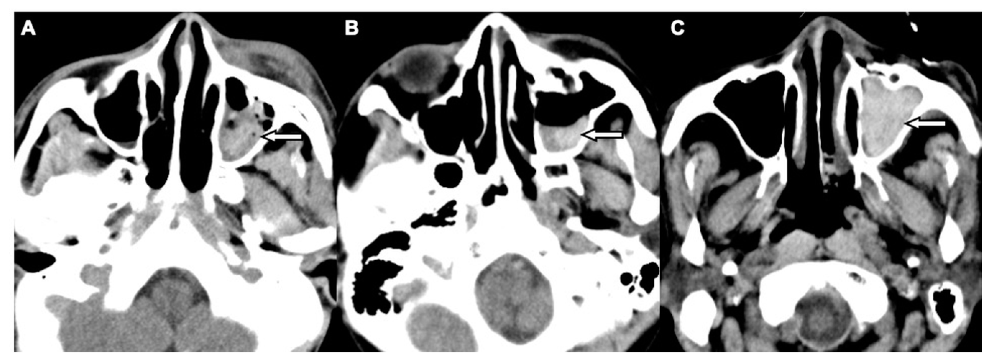 Jcm 08 01852 g003 Jcm 08 01852 g003