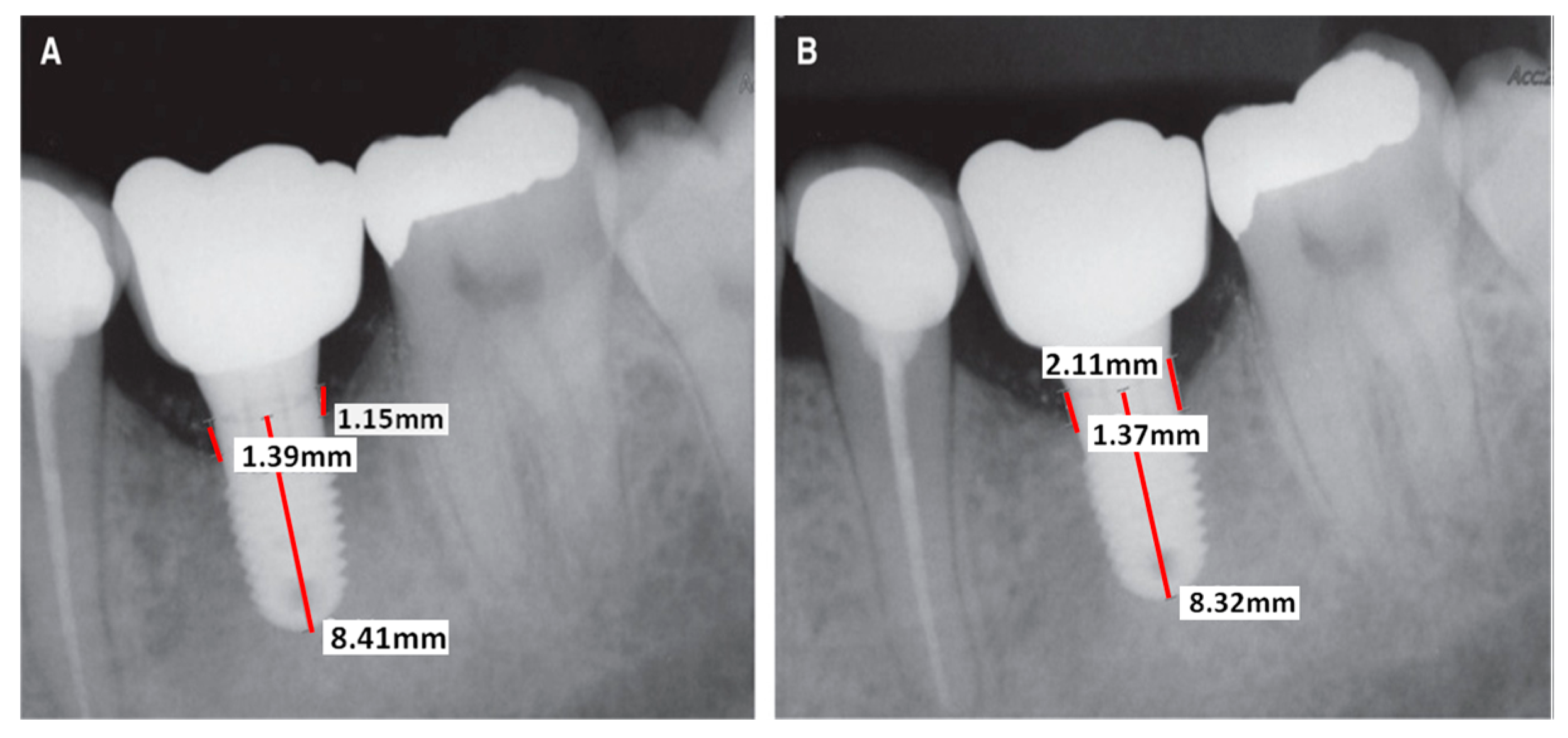 Jcm 08 01982 g006 Jcm 08 01982 g006
