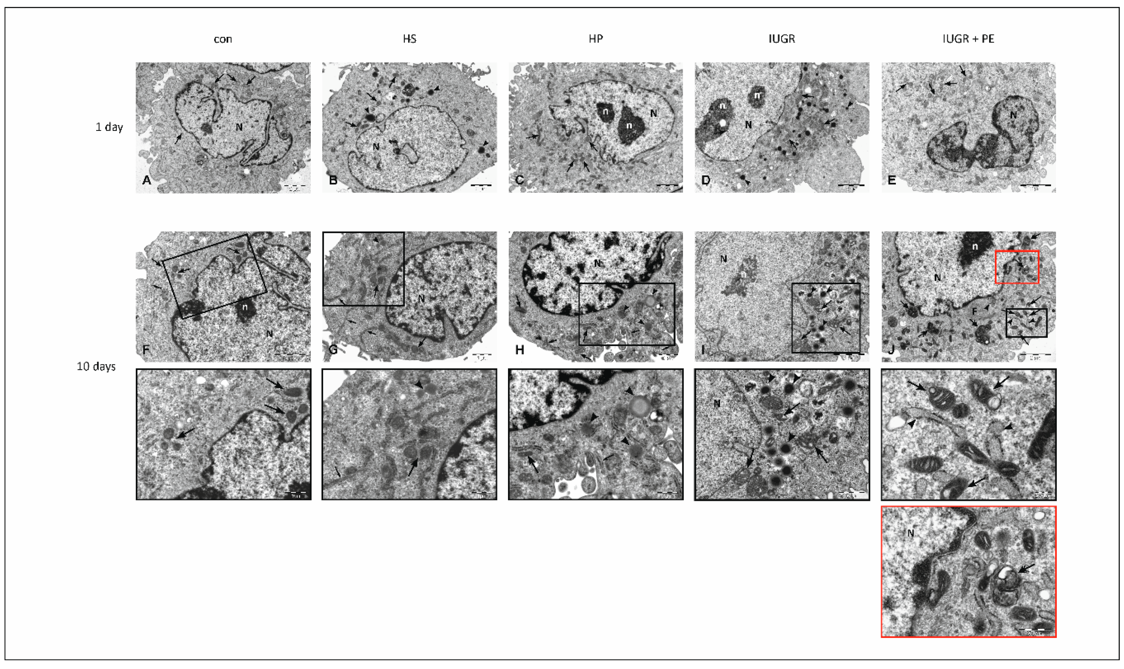 Jcm 08 01994 g005 Jcm 08 01994 g005