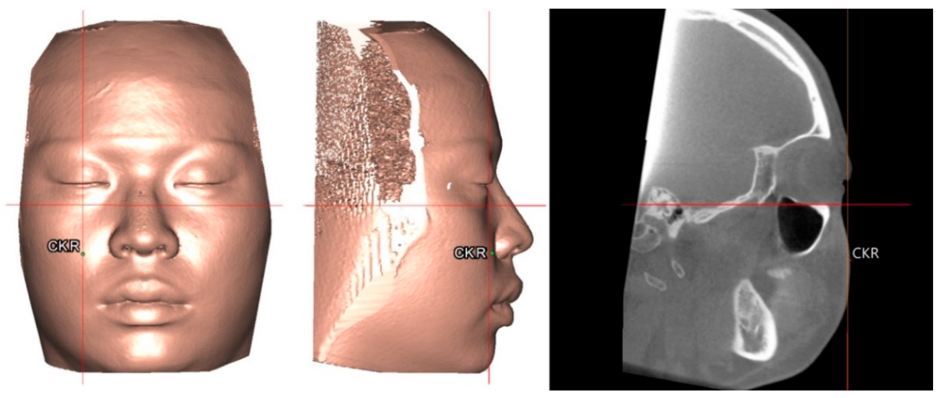 Jcm 08 02106 g004 Jcm 08 02106 g004