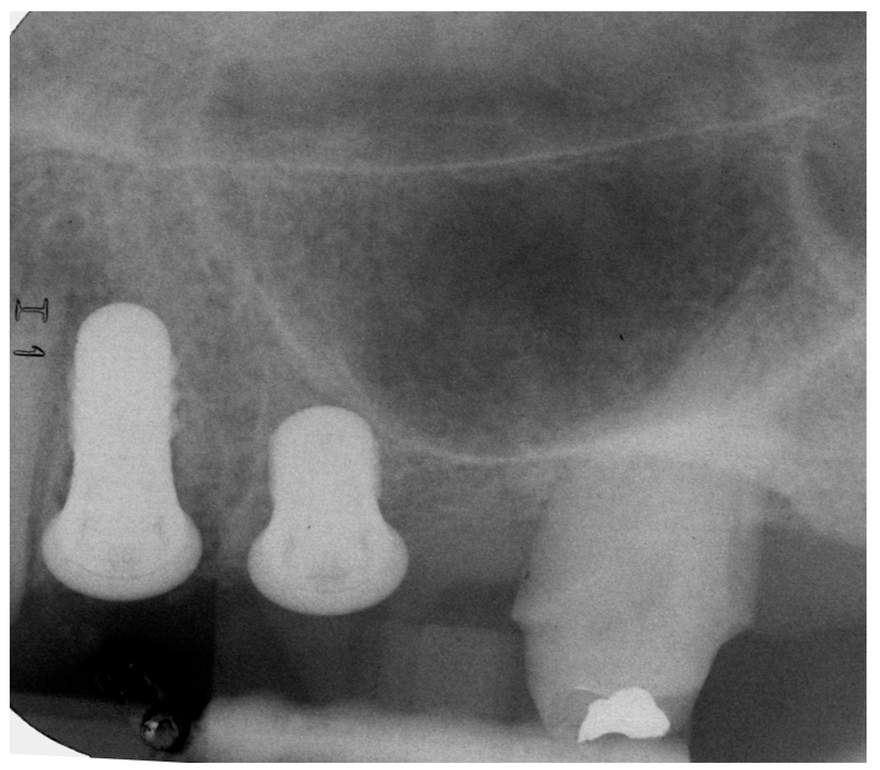 Jcm 09 00357 g003 Jcm 09 00357 g003