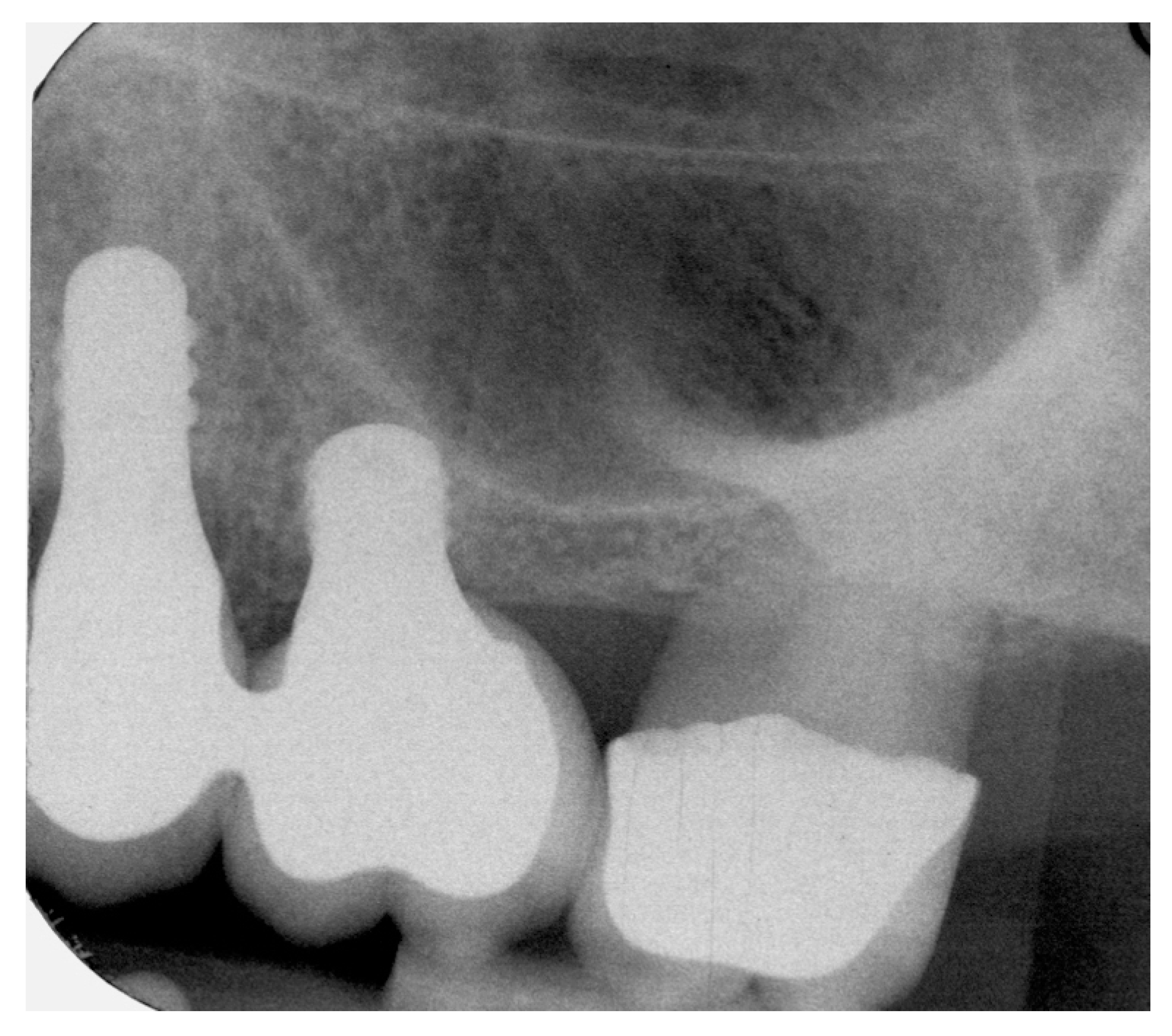 Jcm 09 00357 g004 Jcm 09 00357 g004