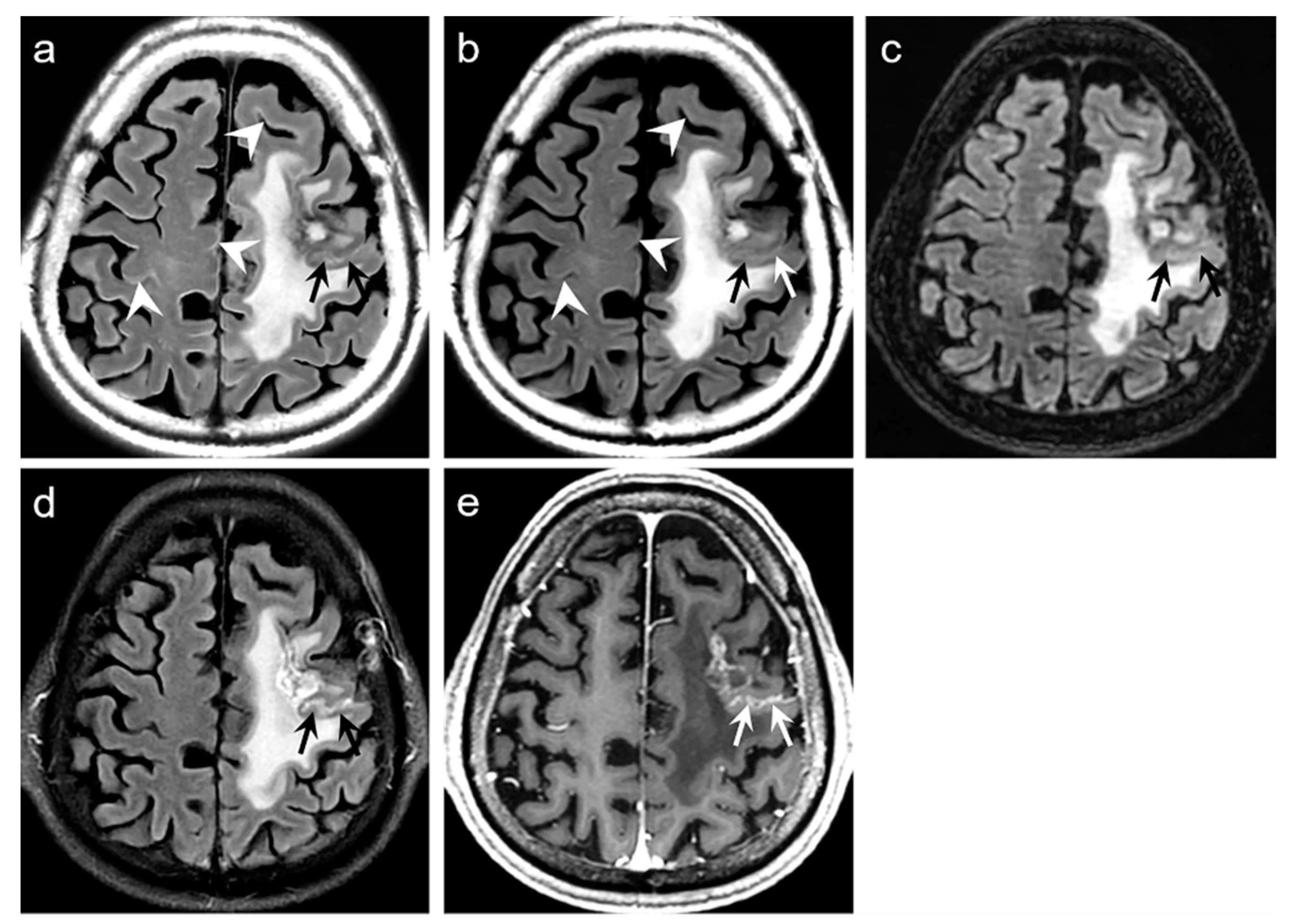 JCM | Free Full-Text | Validation of Deep Learning-Based Artifact ...