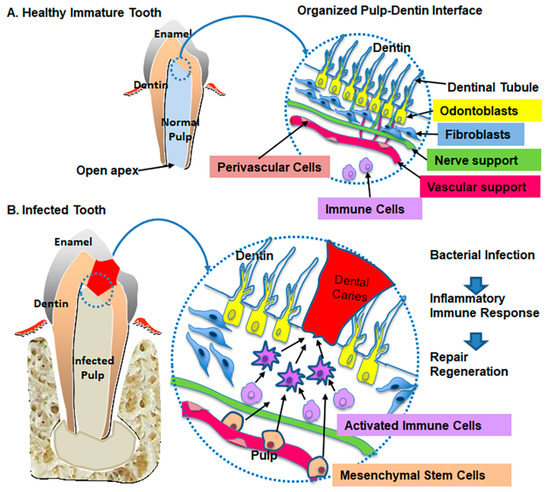 JCM | Free Full-Text | Pulp–Dentin Tissue Healing Response: A Discussion of  Current Biomedical Approaches