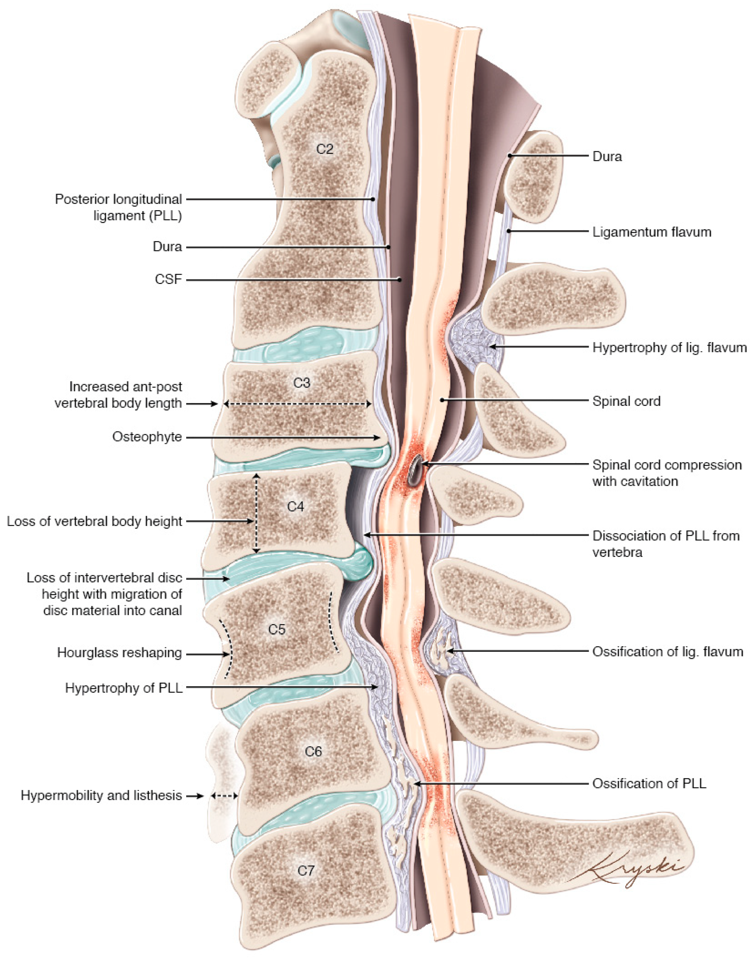 Cervicalgia (neck pain) - Back center Geneva