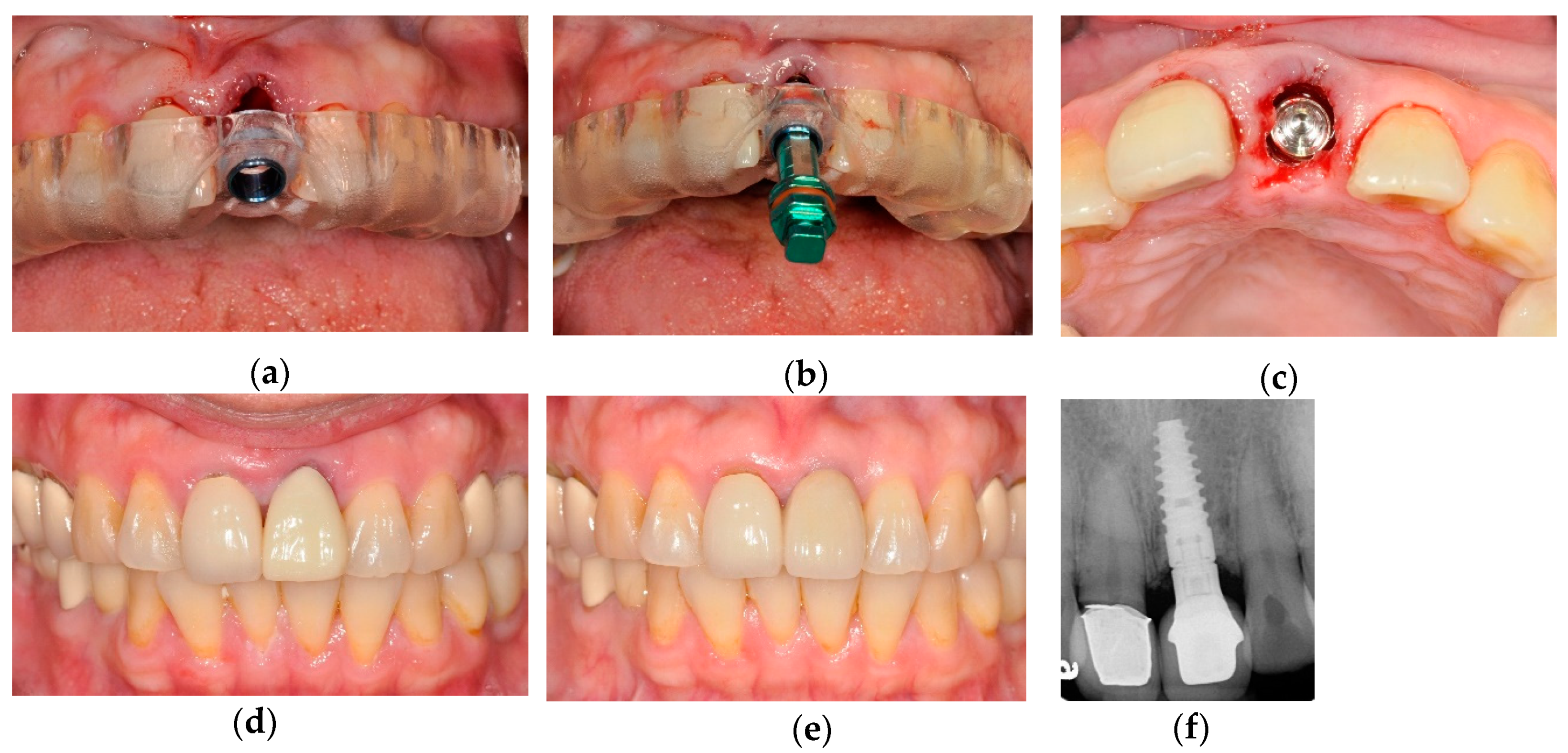 Jcm 09 00980 g004 Jcm 09 00980 g004