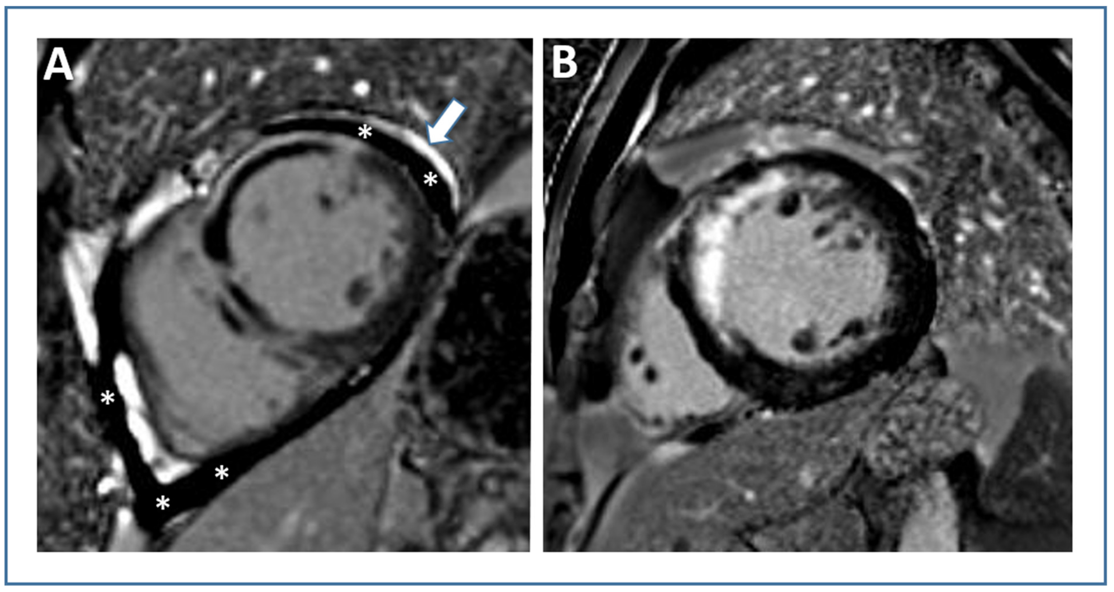 JCM | Free Full-Text | Role of Cardiac Magnetic Resonance to Improve ...