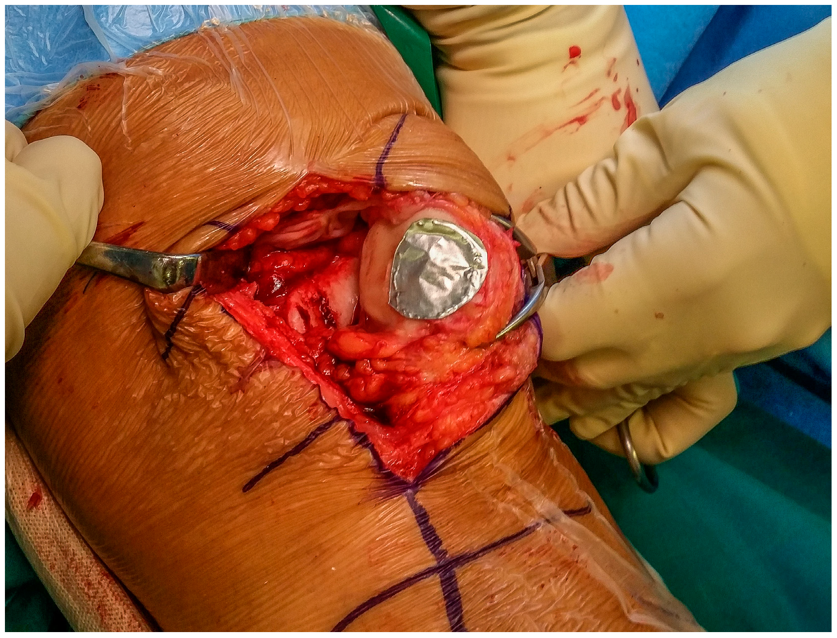 Jcm 09 01184 g002 Jcm 09 01184 g002