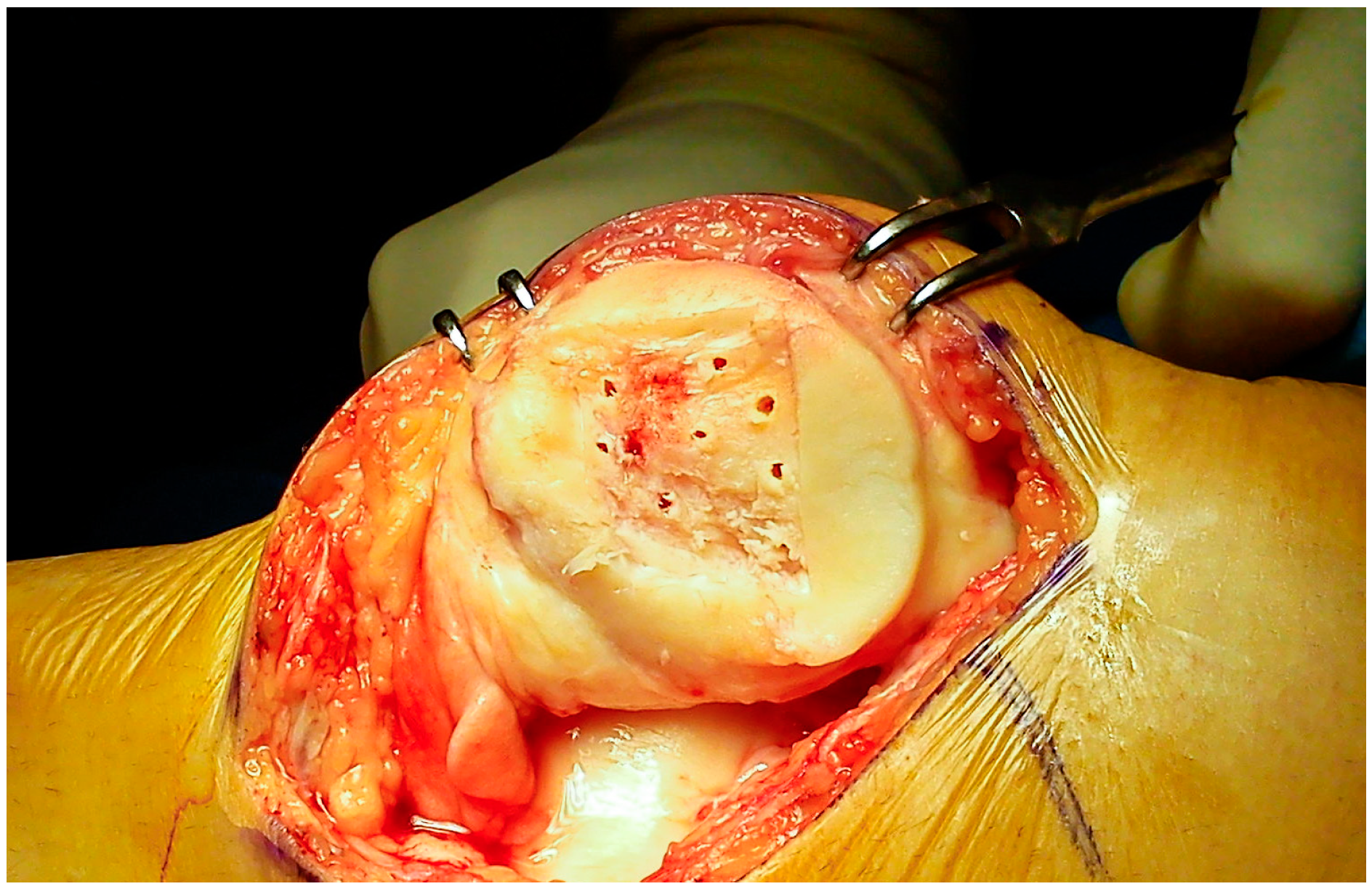 Jcm 09 01184 g003 Jcm 09 01184 g003