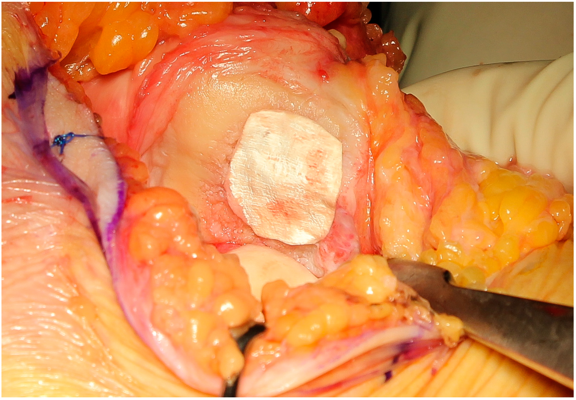 Jcm 09 01184 g004 Jcm 09 01184 g004