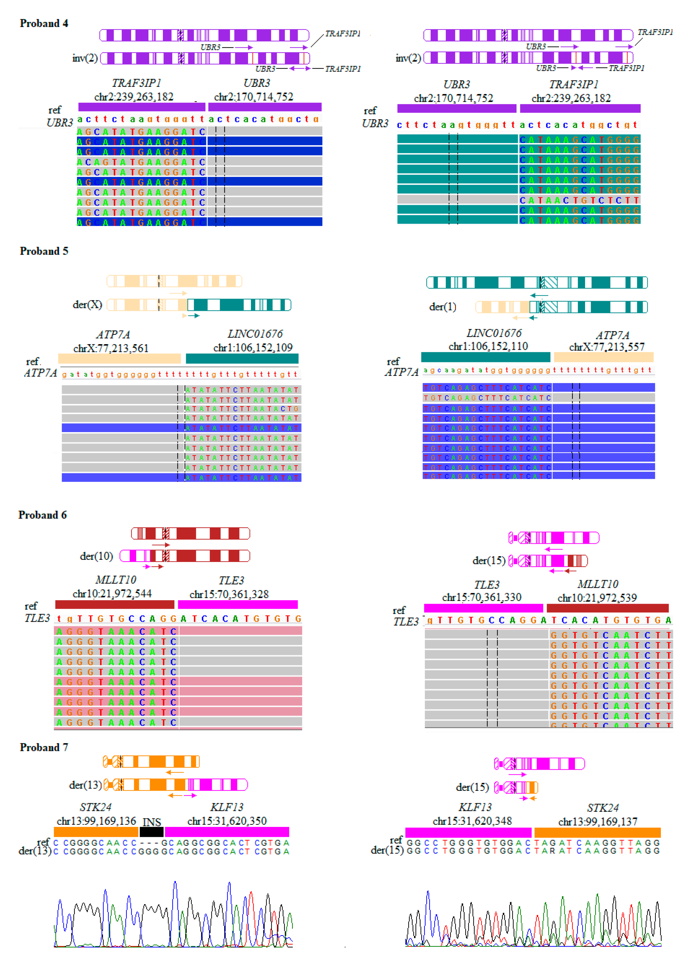 Jcm Free Full Text Breakpoint Mapping Of Symptomatic Balanced Translocations Links The Epha6 Klf13 And Ubr3 Genes To Novel Disease Phenotype Html