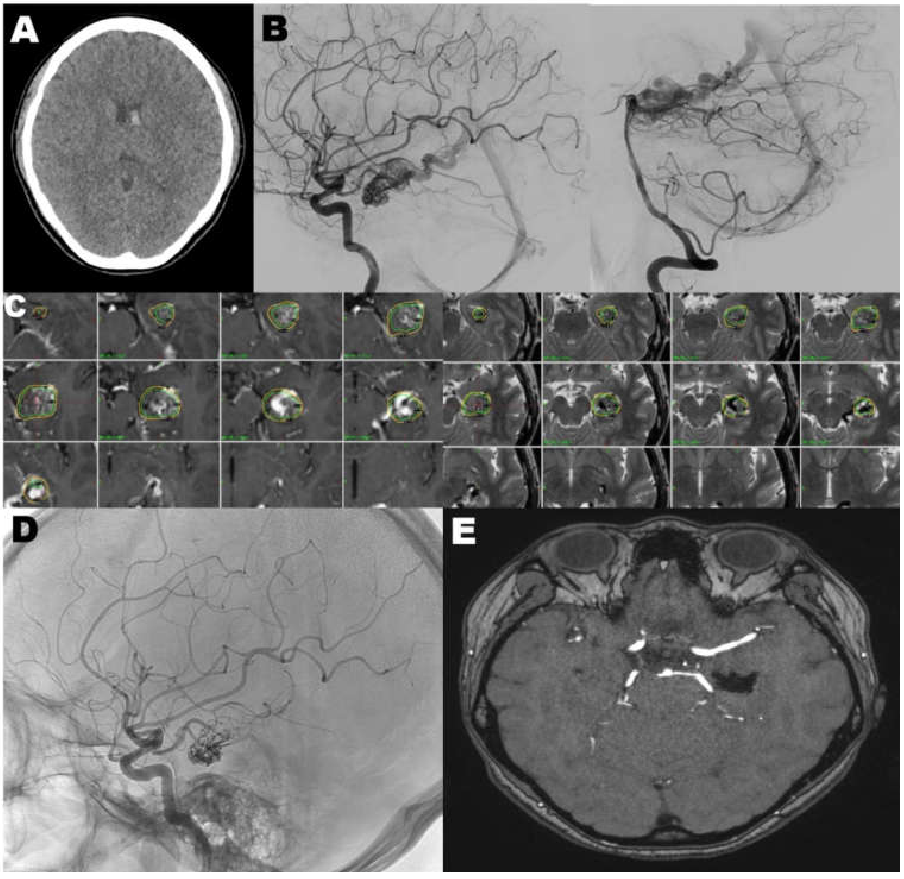 Jcm 09 01318 g002 Jcm 09 01318 g002