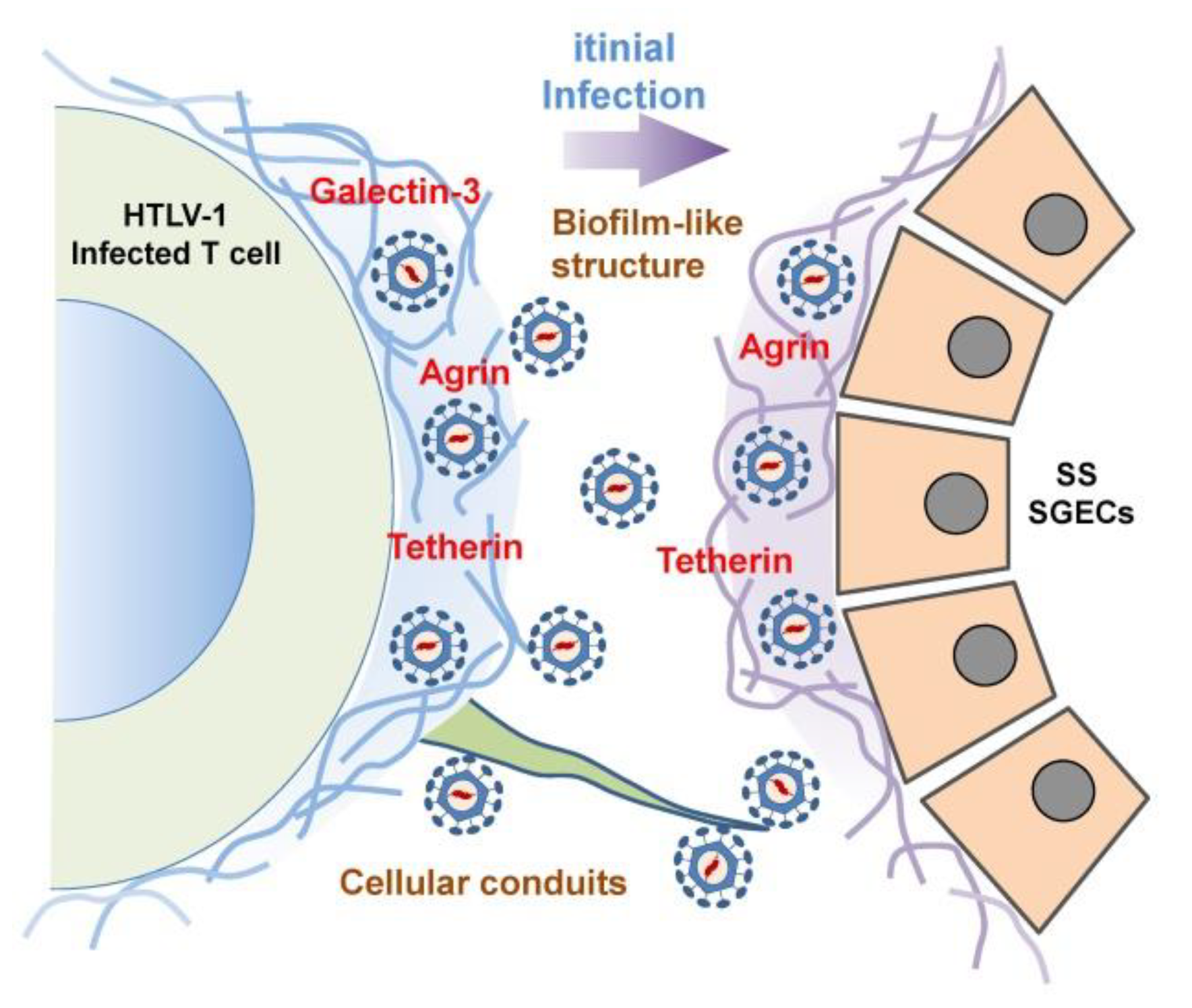 JCM | Free Full-Text | Role of Viral Infections in the Pathogenesis of  Sjögren's Syndrome: Different Characteristics of Epstein-Barr Virus and HTLV -1