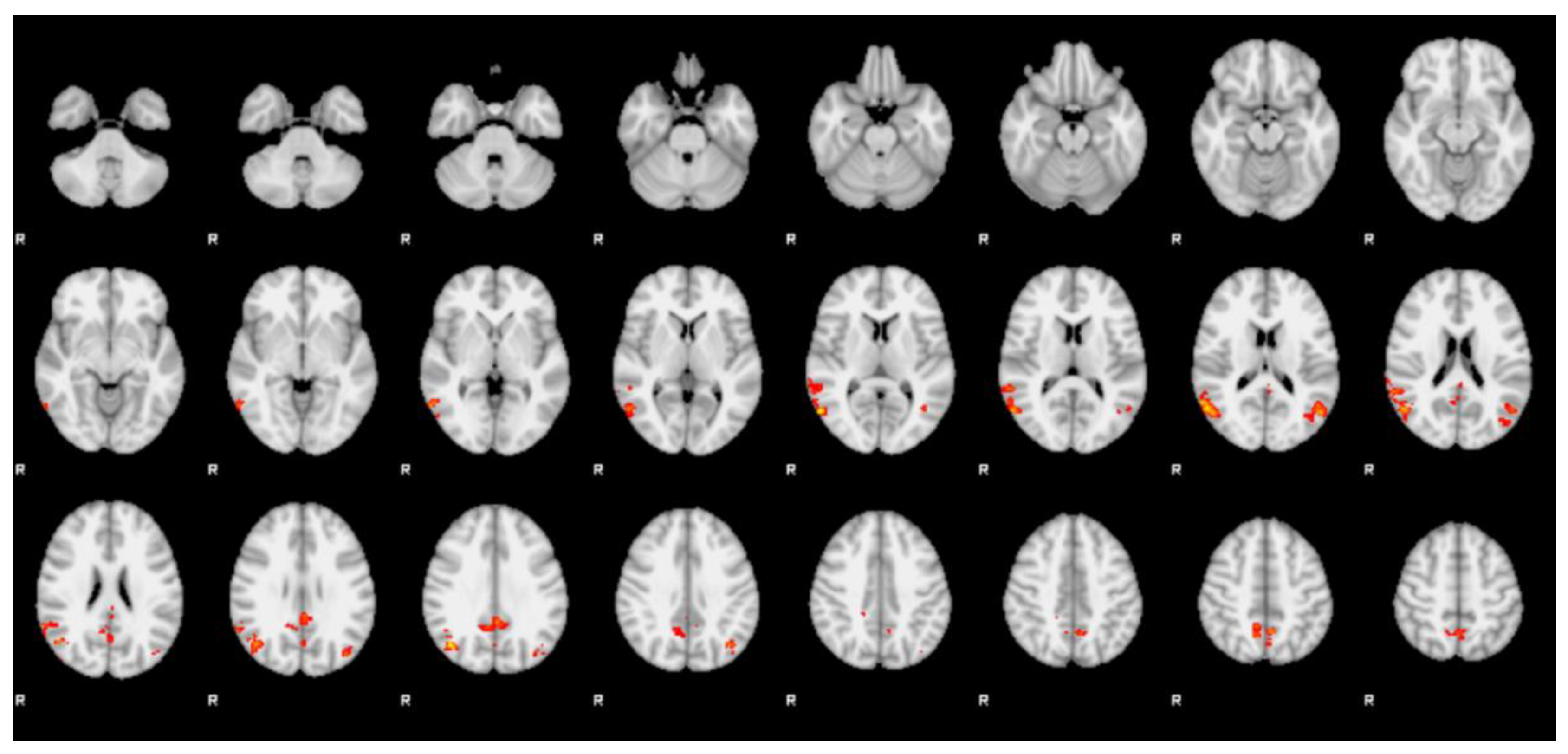 Jcm 09 01731 g003 Jcm 09 01731 g003