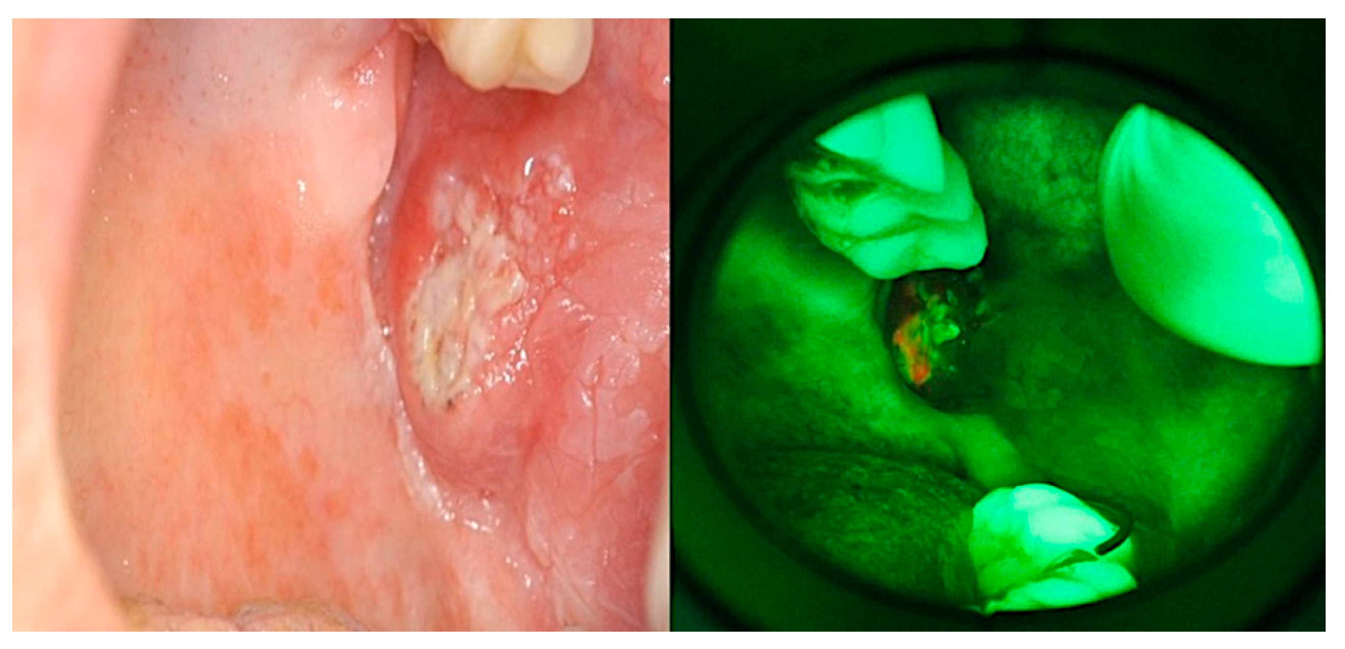 Jcm 09 01754 g003 Jcm 09 01754 g003