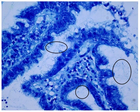 JCM | Free Full-Text | Transient and Persistent Gastric Microbiome ...