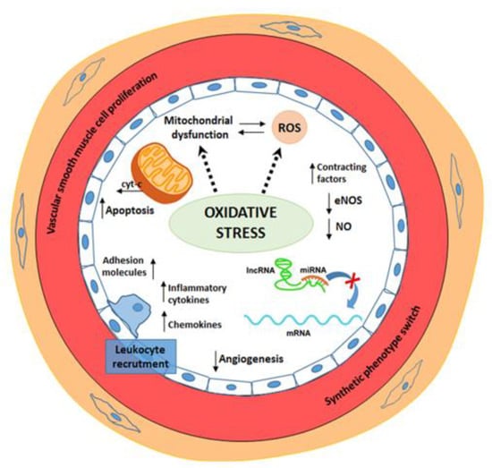 JCM | Free Full-Text | Oxidative Stress and New Pathogenetic Mechanisms in  Endothelial Dysfunction: Potential Diagnostic Biomarkers and Therapeutic  Targets | HTML