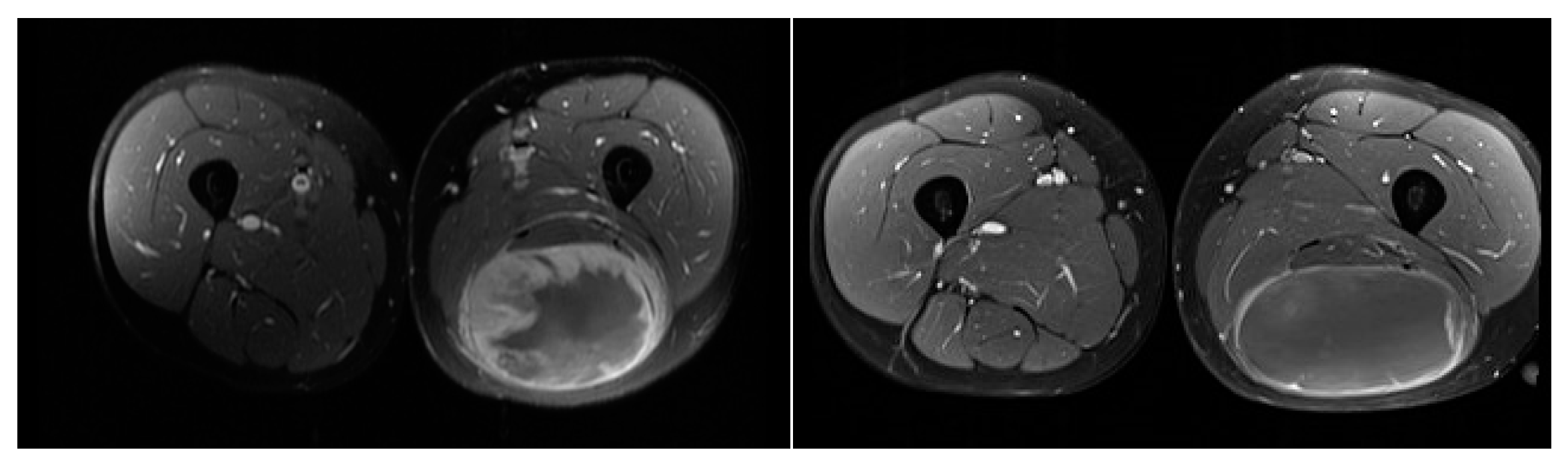 Jcm 09 02471 g002 Jcm 09 02471 g002