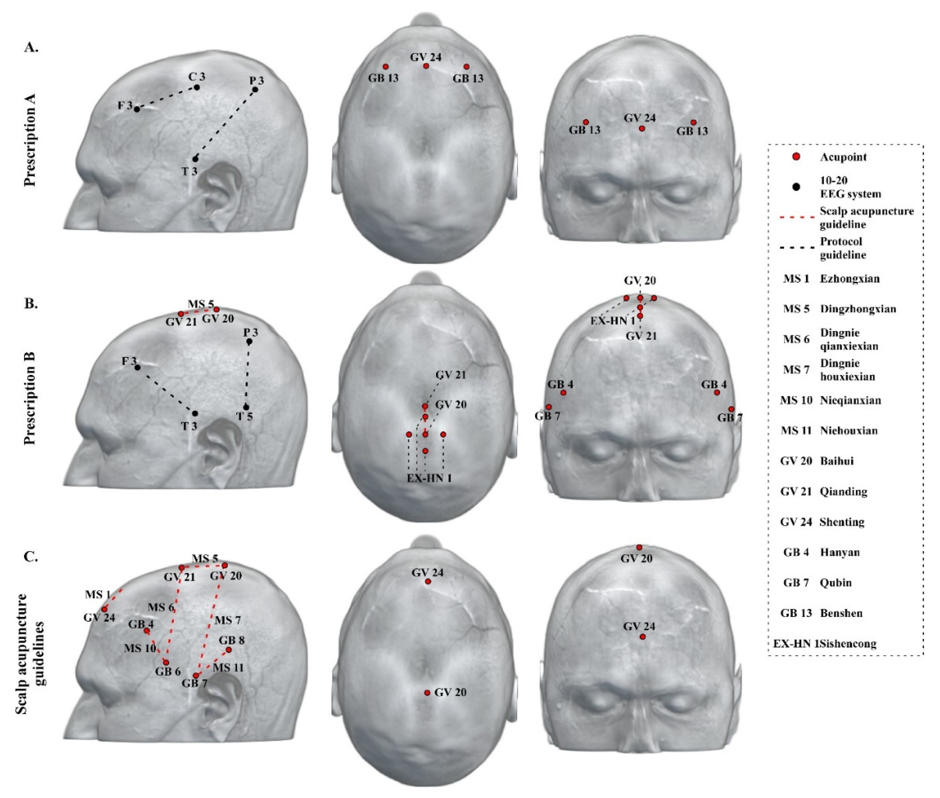 JCM | Free Full-Text | Neuroimaging-Based Scalp Acupuncture Locations for  Dementia