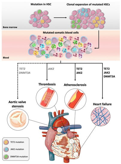 Distinction of lymphoid and myeloid clonal hematopoiesis