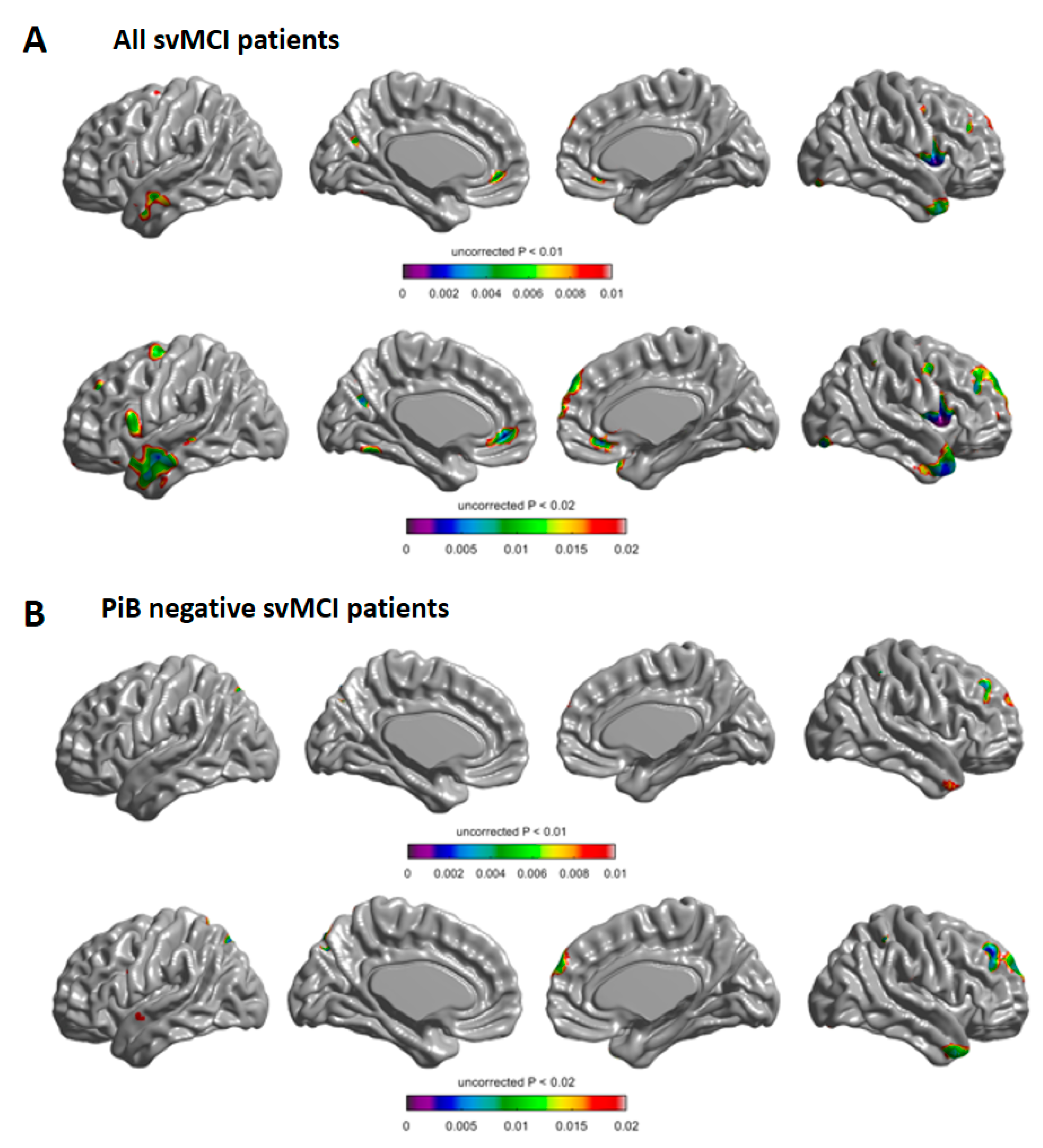 White Matter Hyperintensities: Complex Predictor of Complex Outcomes