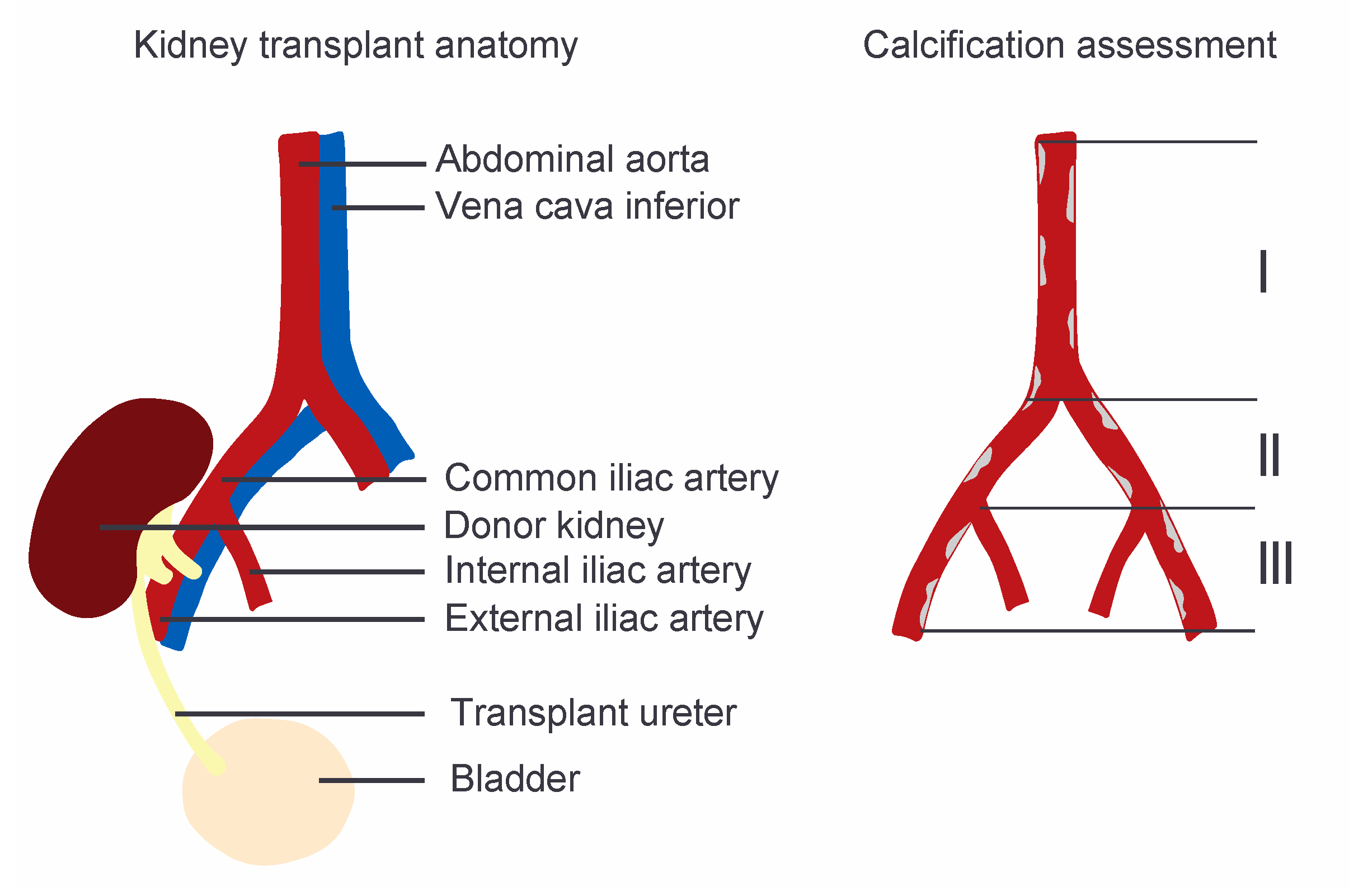 external iliac arteries cat