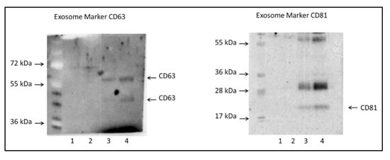 Jcm Free Full Text Proteomic Profiles Of Exosomes Of Septic Patients Presenting To The Emergency Department Compared To Healthy Controls Html