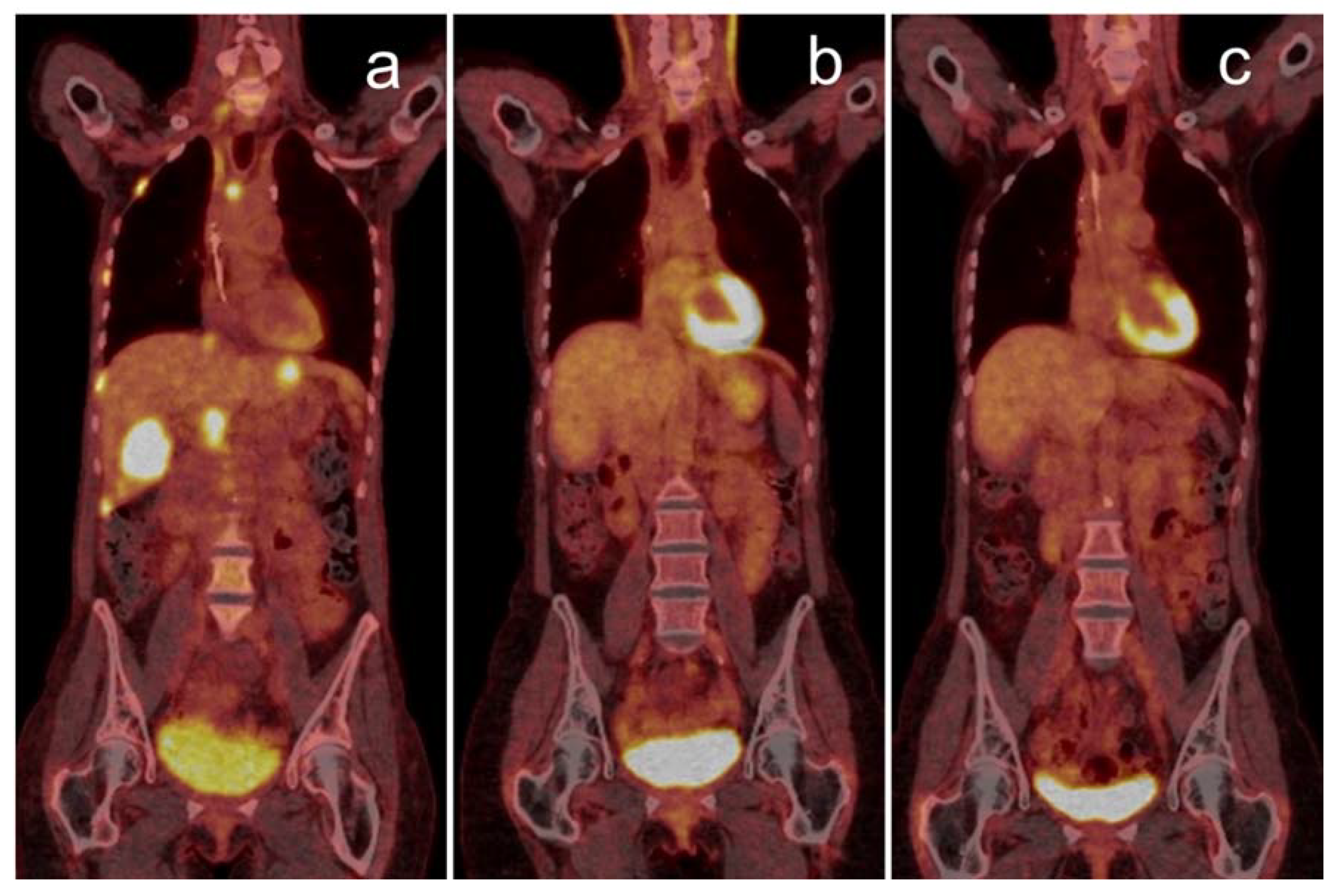 JCM | Free Full-Text | Impact of PET/CT for Assessing Response to  Immunotherapy—A Clinical Perspective | HTML